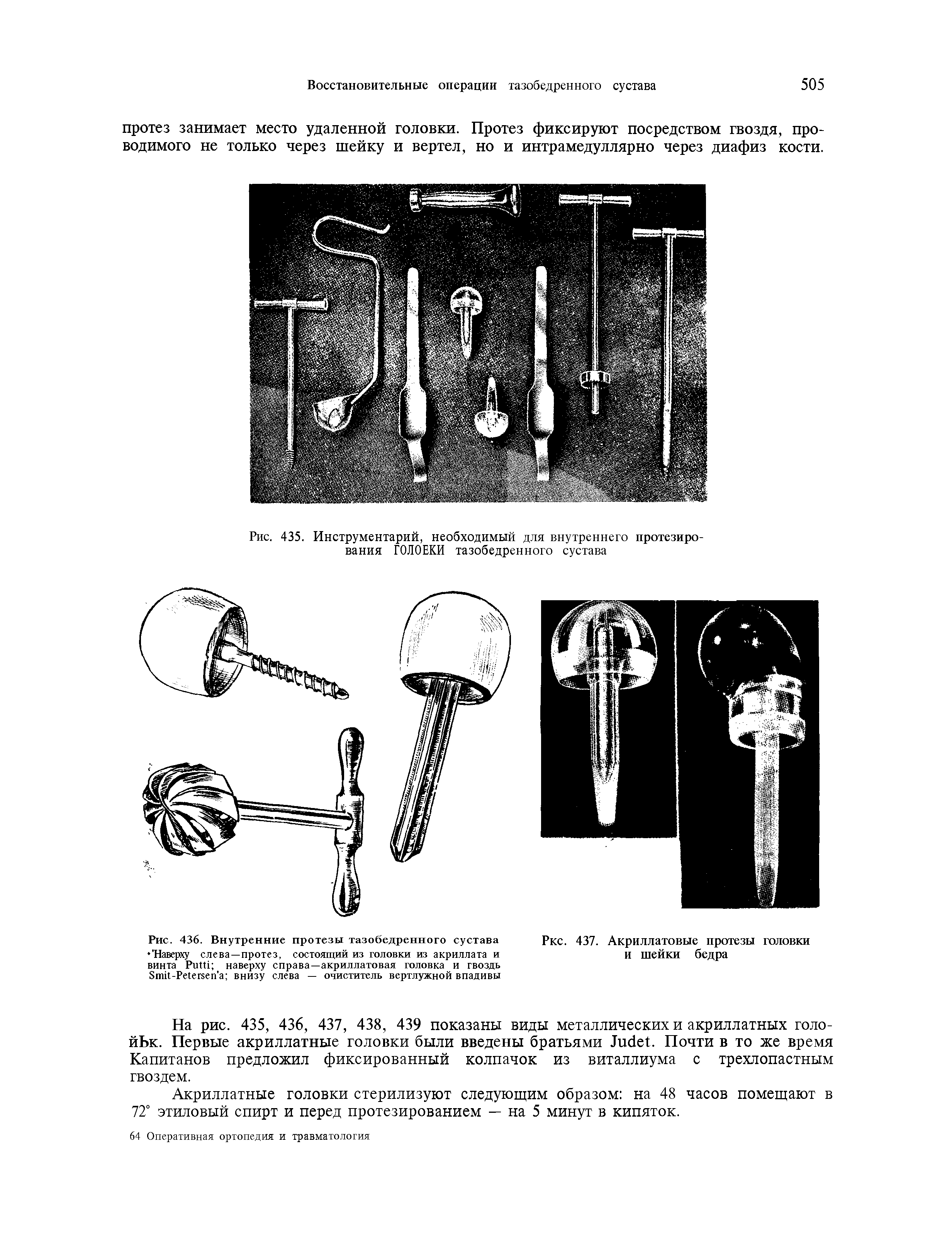 Рис. 436. Внутренние протезы тазобедренного сустава Наверху слева—протез, состоящий из головки из акриллата и винта РиШ наверху справа—акриллатовая головка и гвоздь Зтй-Р егееп а внизу слева — очиститель вертлужной впадивы...