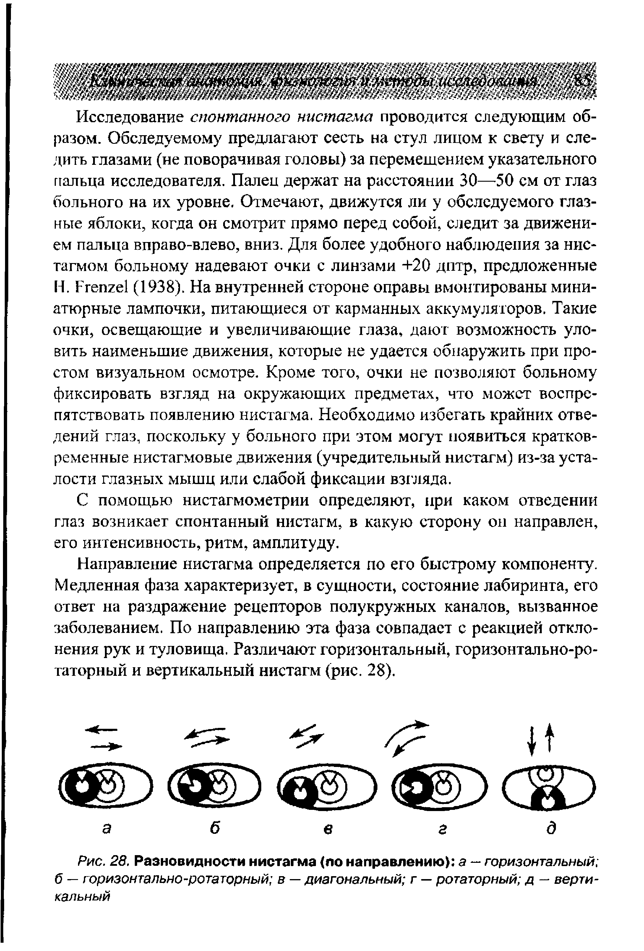 Рис. 28. Разновидности нистагма (по направлению) а — горизонтальный б — горизонтально-ротаторный в — диагональный г — ротаторный д — вертикальный...