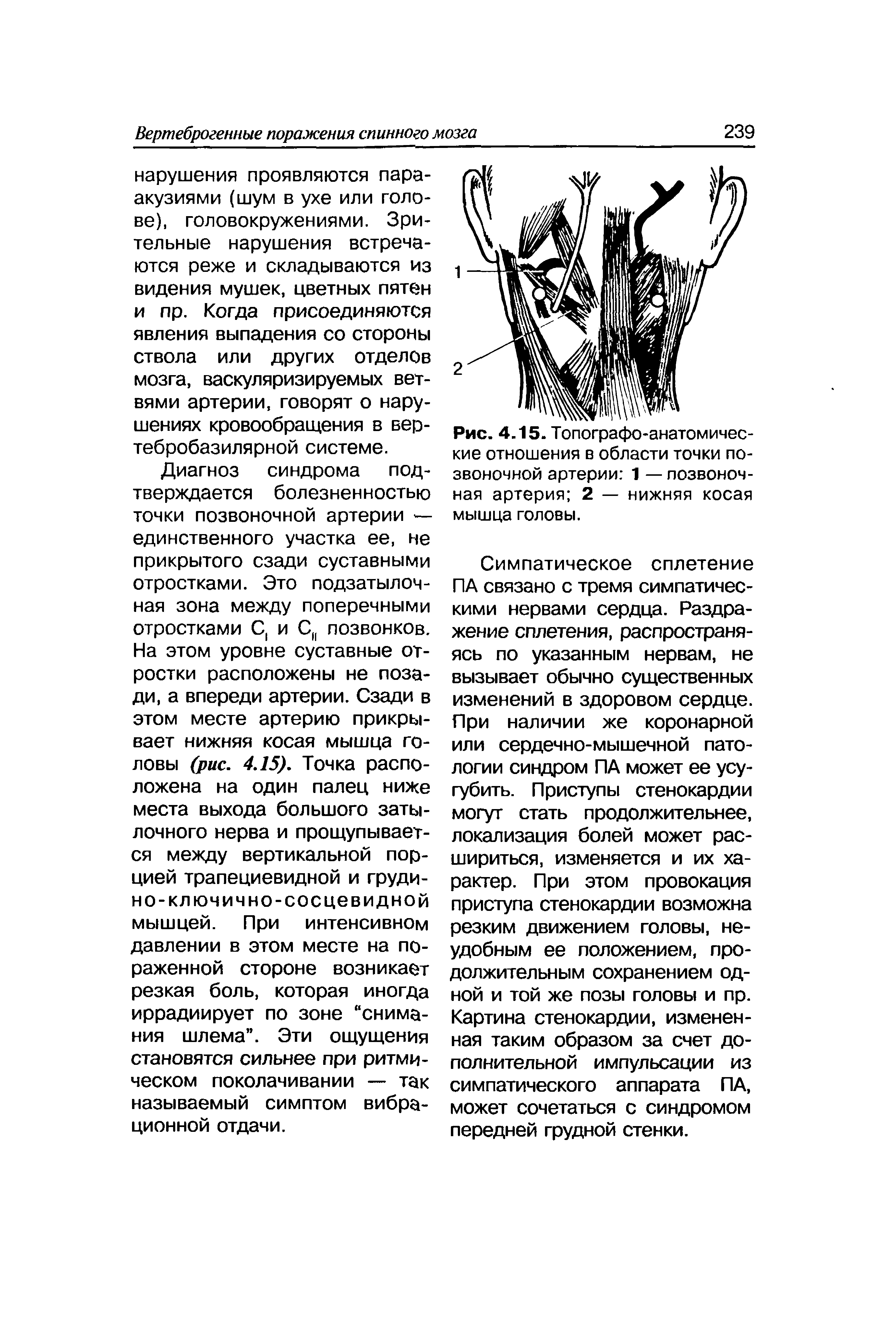 Рис. 4.15. Топографо-анатомические отношения в области точки позвоночной артерии 1 — позвоночная артерия 2 — нижняя косая мышца головы.