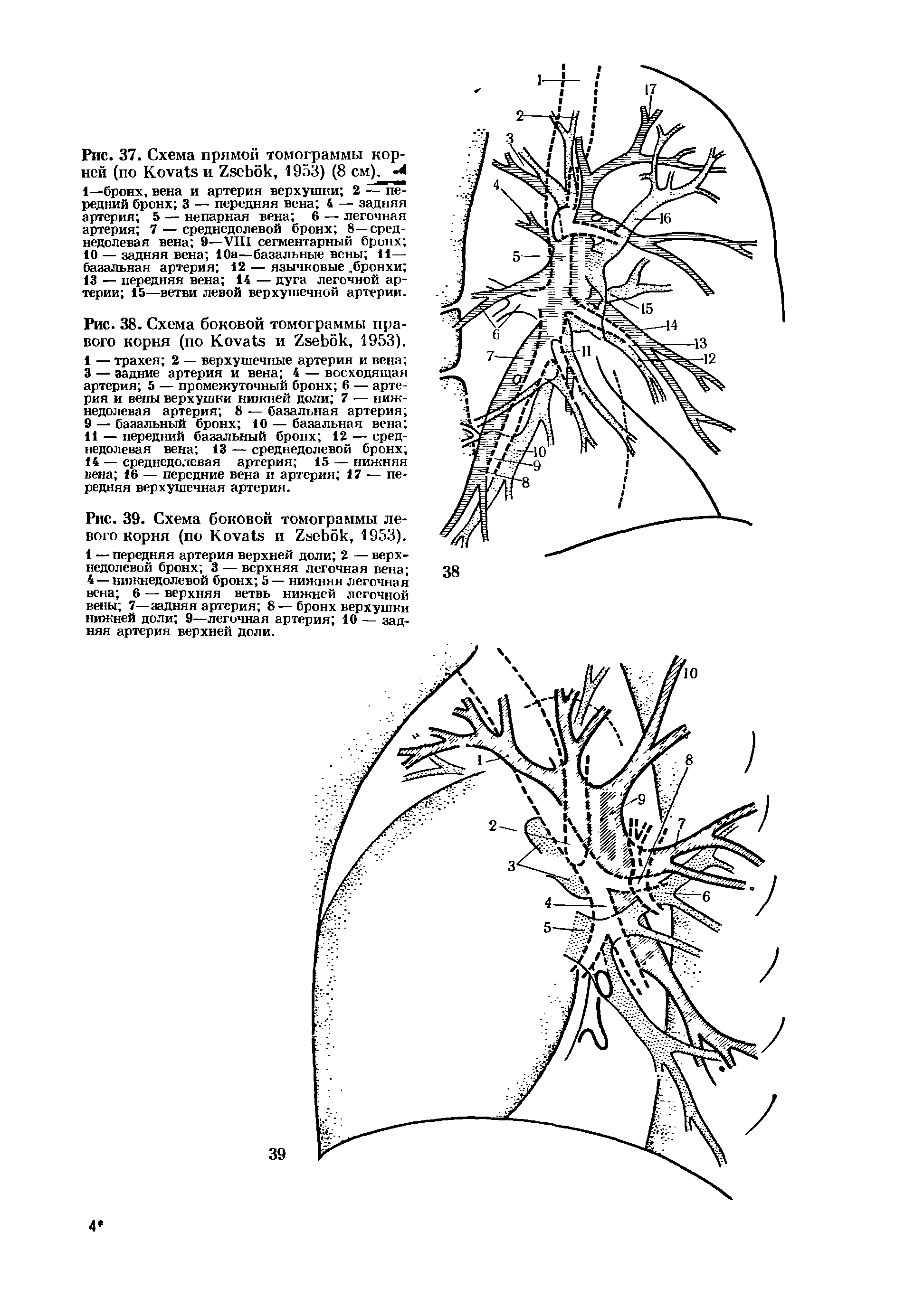 Рис. 39. Схема боковой томограммы левого корня (по K и Z , 1953). 1 — передняя артерия верхней доли 2 — верхнедолевой бронх 3 — верхняя легочная вена ...