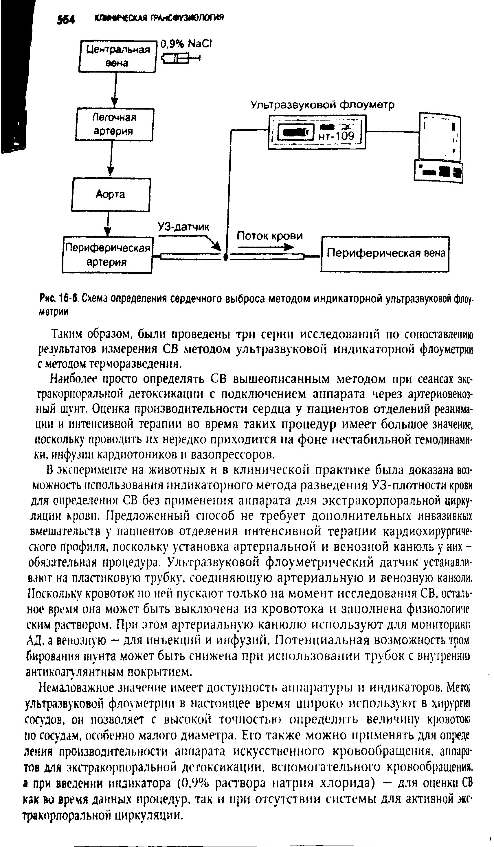 Рис. 168. Схема определения сердечного выброса методом индикаторной ультразвуковой флоуметрии...