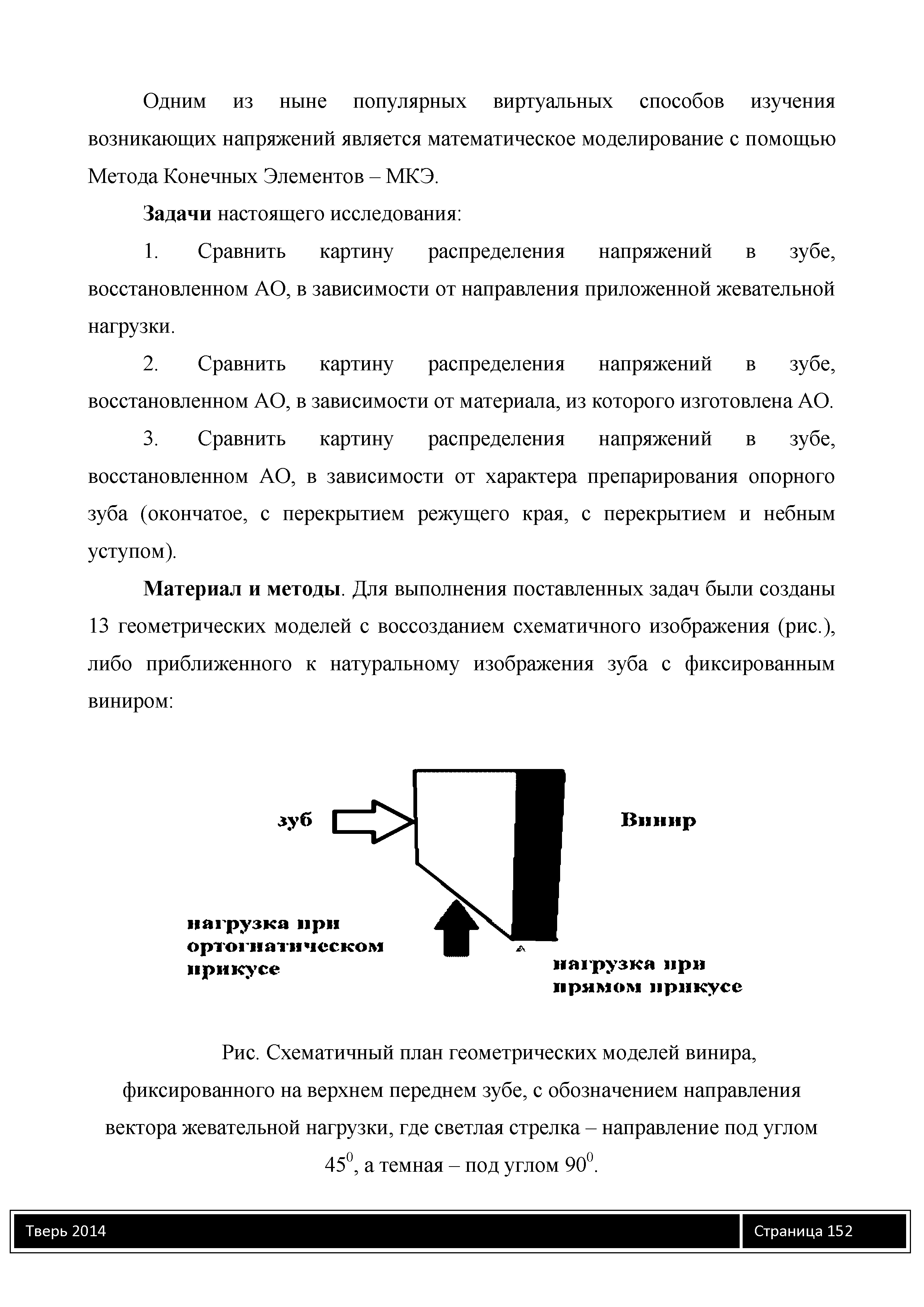 Рис. Схематичный план геометрических моделей винира, фиксированного на верхнем переднем зубе, с обозначением направления вектора жевательной нагрузки, где светлая стрелка - направление под углом 45°, а темная - под углом 90°.