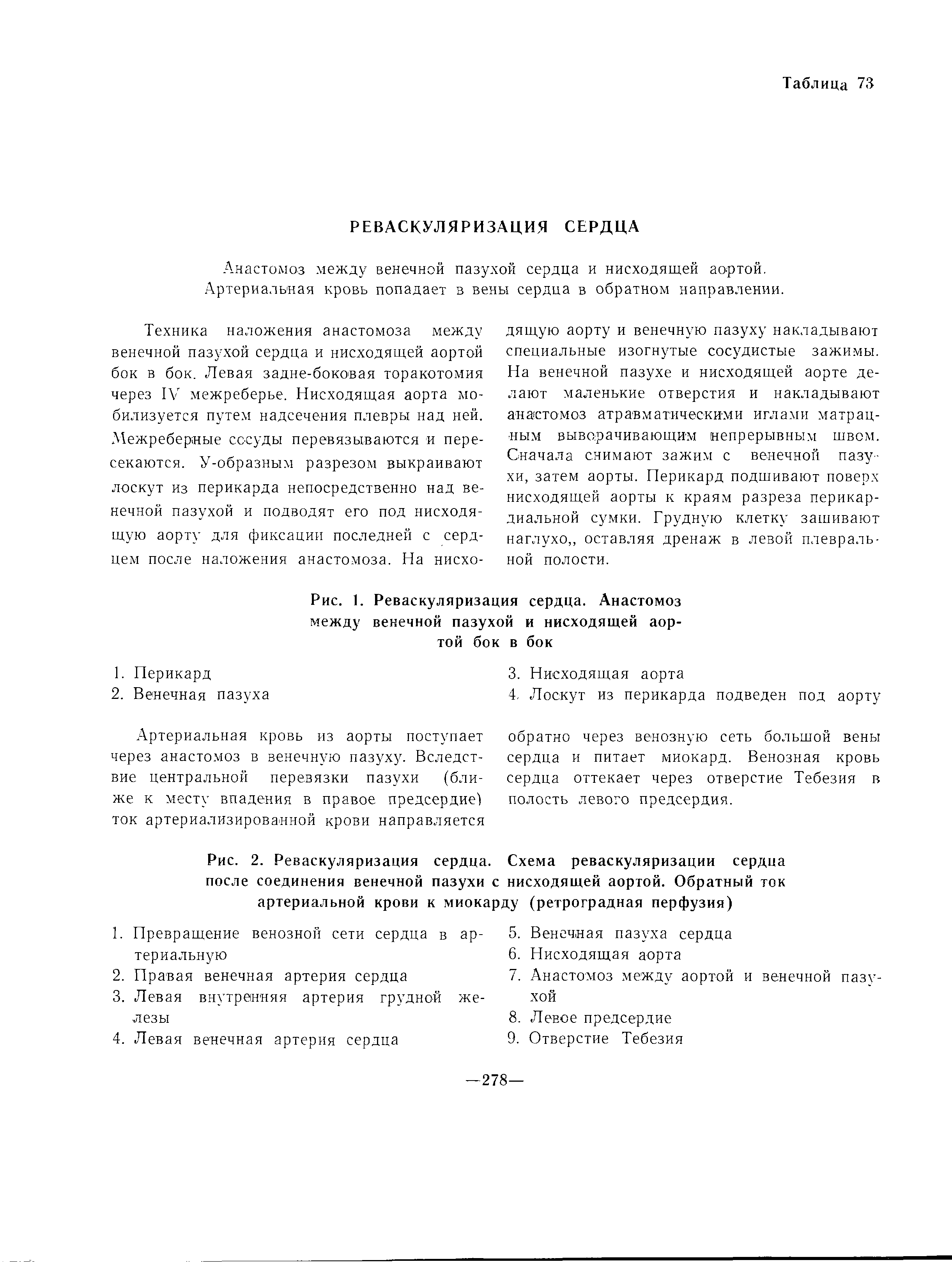 Рис. 1. Реваскуляризация сердца. Анастомоз между венечной пазухой и нисходящей аортой бок в бок...