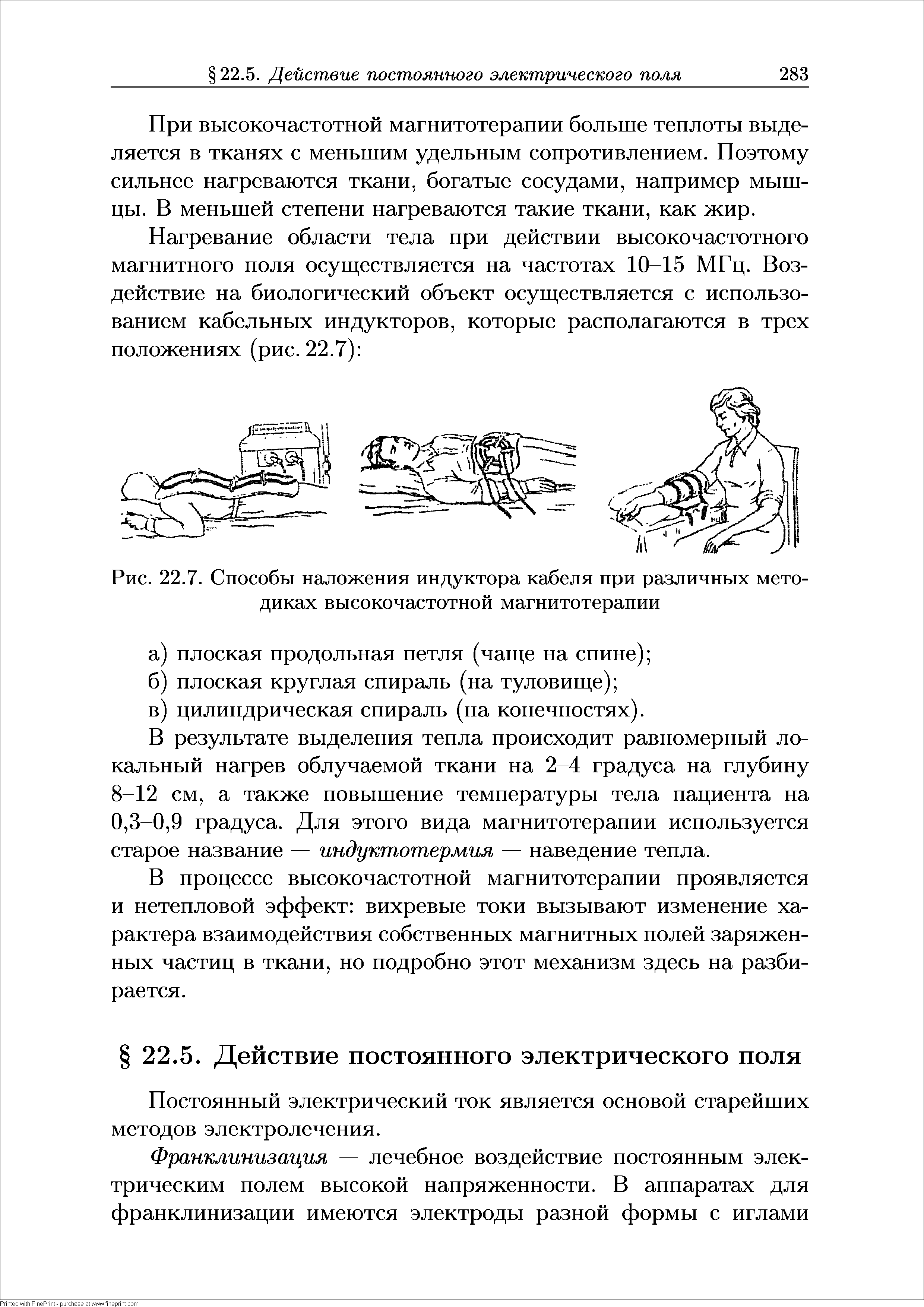 Рис. 22.7. Способы наложения индуктора кабеля при различных методиках высокочастотной магнитотерапии...