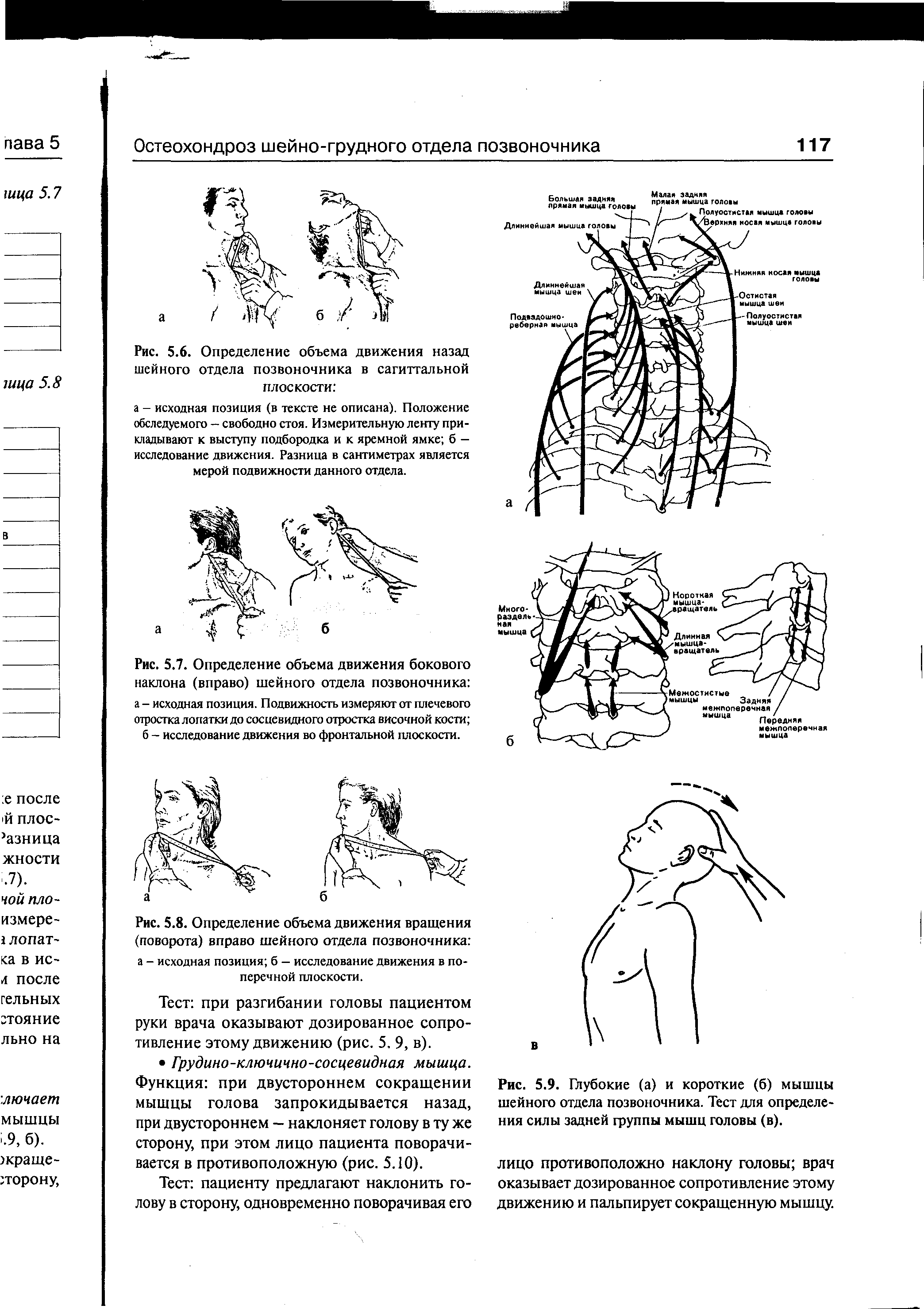 Рис. 5.9. Глубокие (а) и короткие (б) мышцы шейного отдела позвоночника. Тест для определения силы задней группы мышц головы (в).