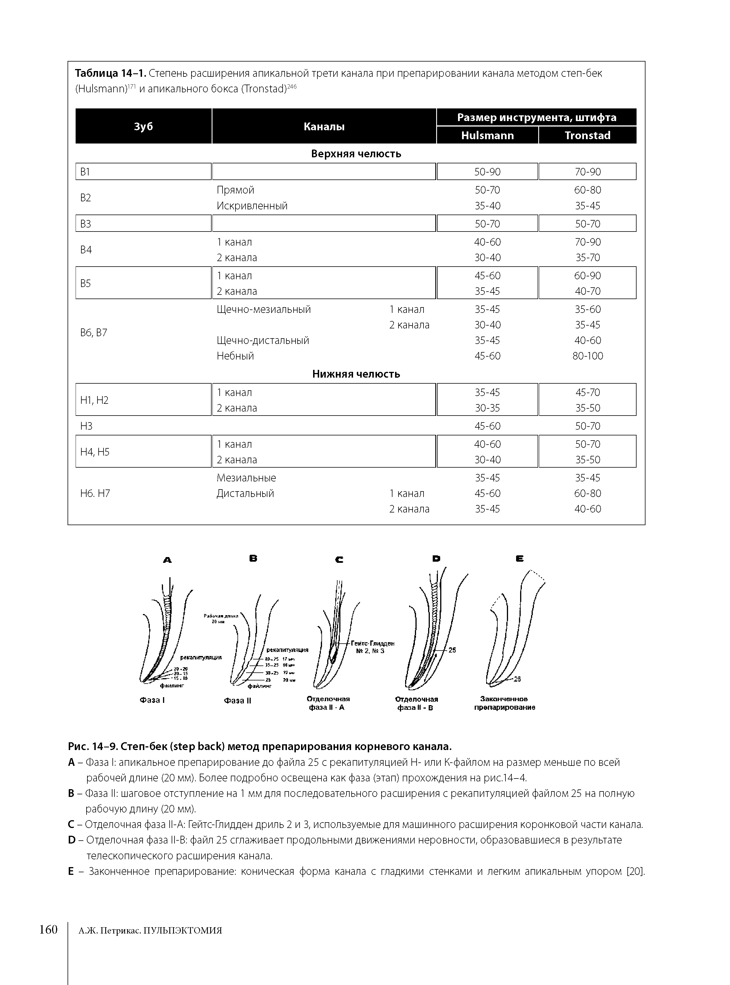 Рис. 14-9. Степ-бек ( ) метод препарирования корневого канала.