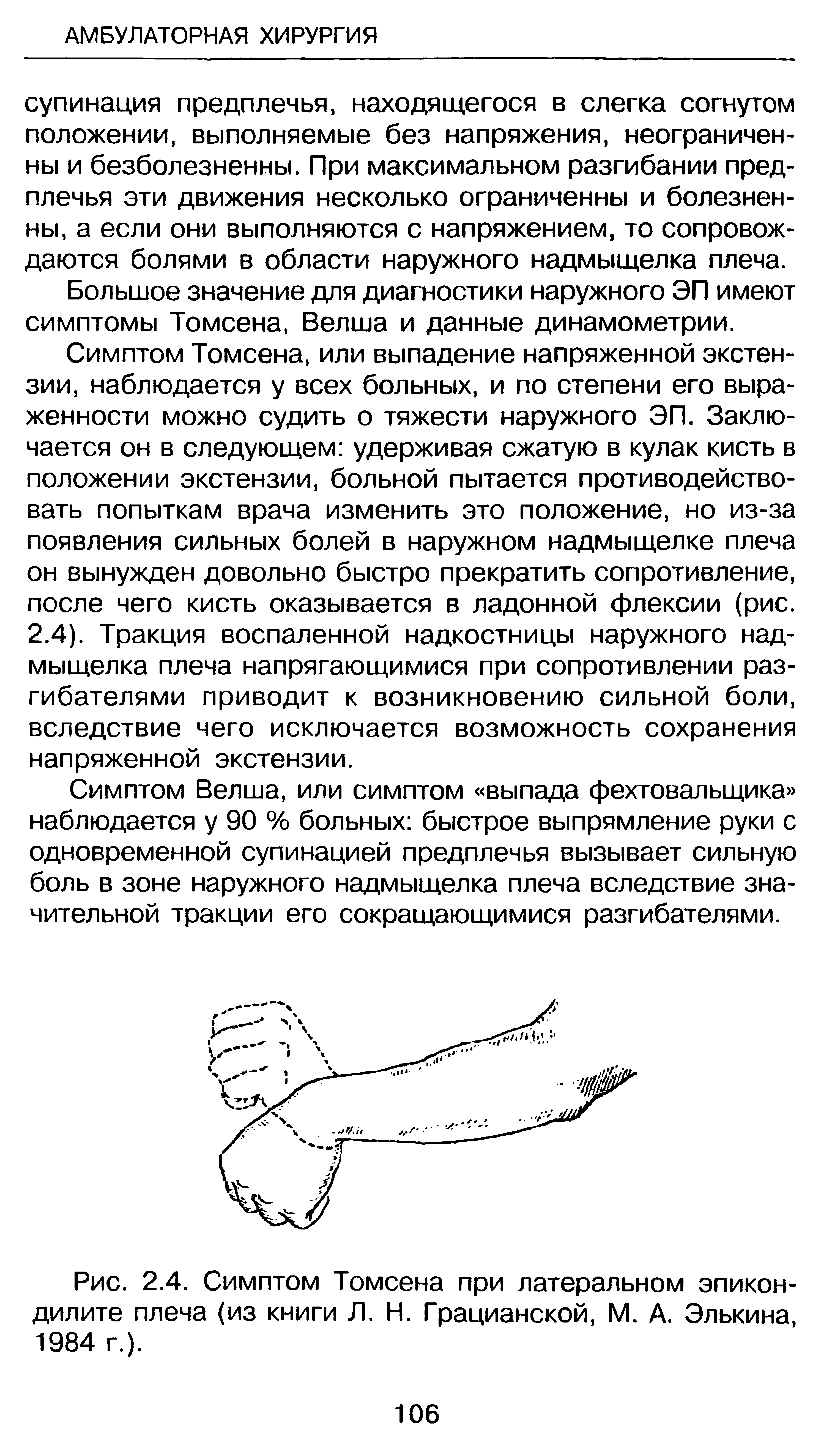 Рис. 2.4. Симптом Томсена при латеральном эпикондилите плеча (из книги Л. Н. Грацианской, М. А. Элькина, 1984 г.).