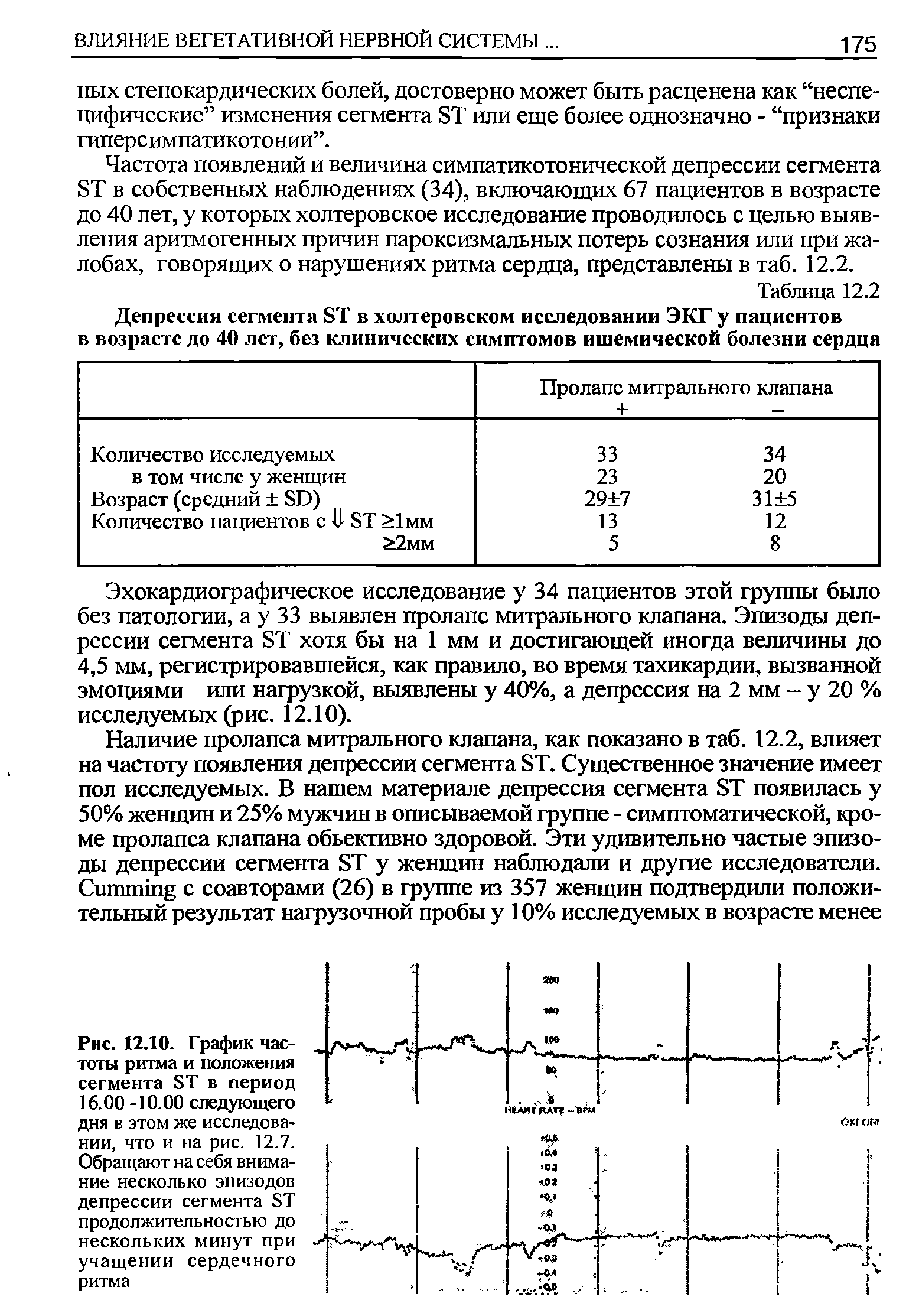 Рис. 12.10. График частоты ритма и положения сегмента ЯТ в период 16.00 -10.00 следующего дня в этом же исследовании, что и на рис. 12.7. Обращают на себя внимание несколько эпизодов депрессии сегмента БТ продолжительностью до нескольких минут при учащении сердечного ритма...