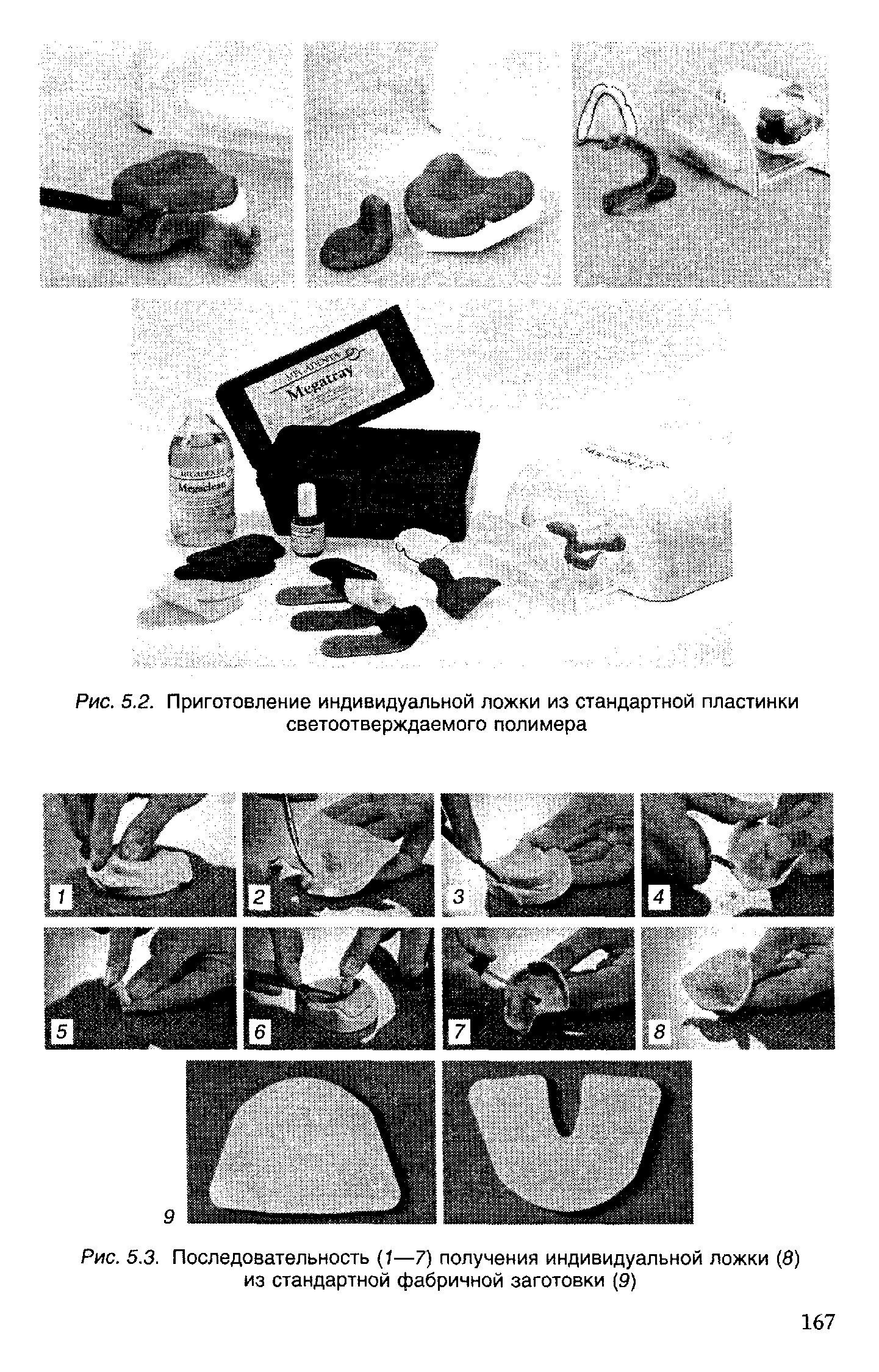 Рис. 5.3. Последовательность (1—7) получения индивидуальной ложки (8) из стандартной фабричной заготовки (9)...