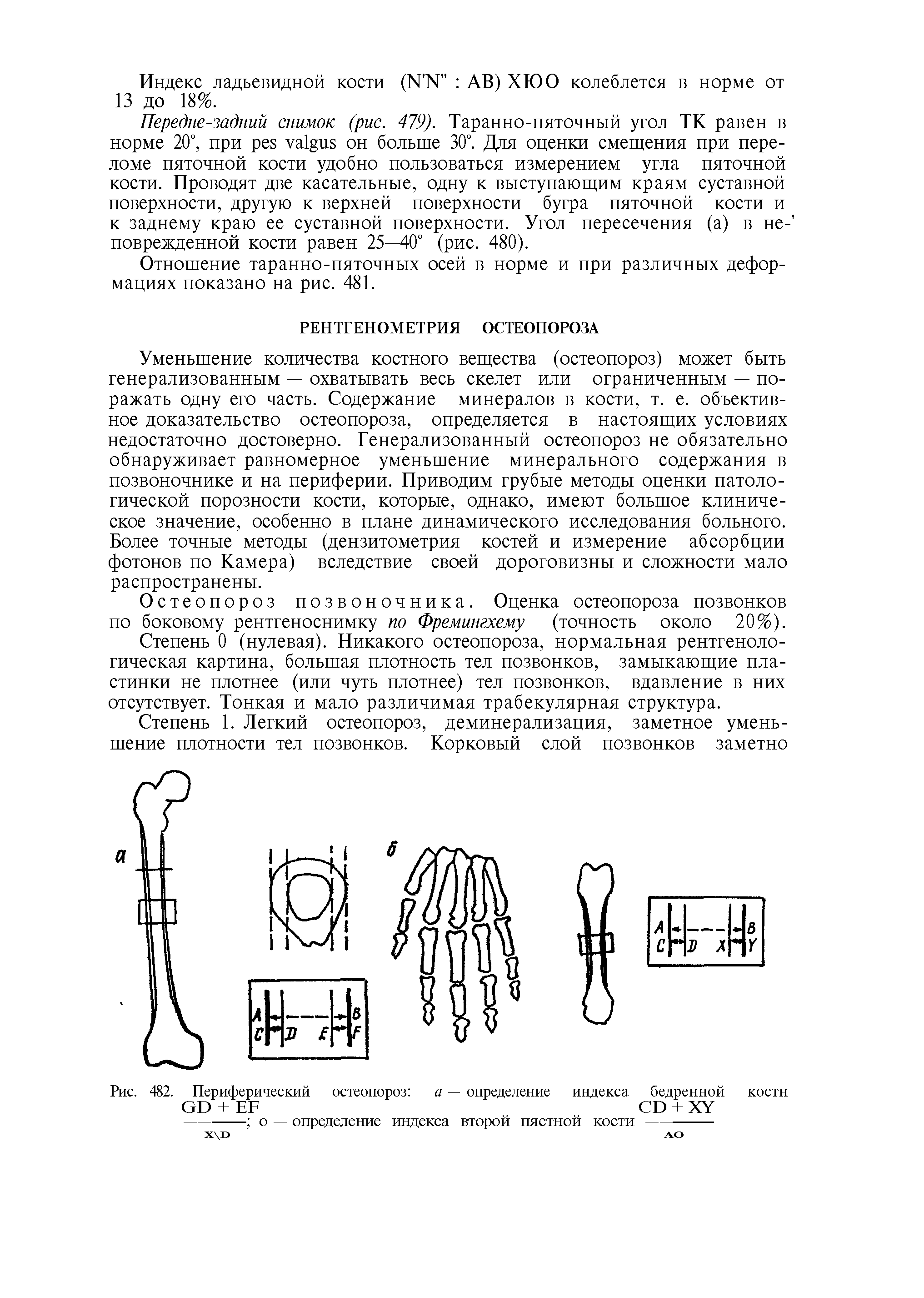 Рис. 482. Периферический остеопороз а — определение индекса бедренной кости...