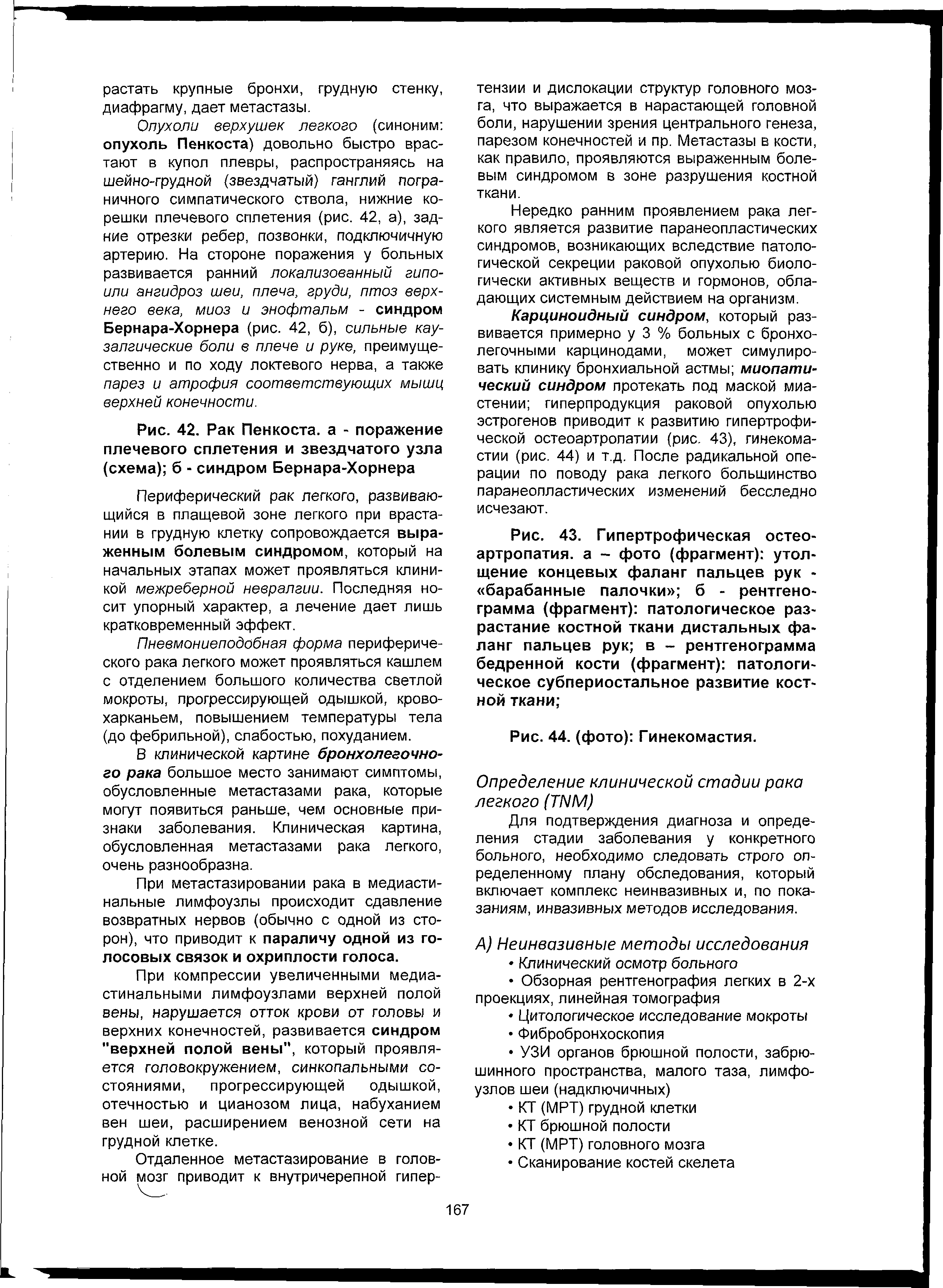 Рис. 43. Гипертрофическая остеоартропатия. а - фото (фрагмент) утолщение концевых фаланг пальцев рук - барабанные палочки б - рентгенограмма (фрагмент) патологическое разрастание костной ткани дистальных фаланг пальцев рук в - рентгенограмма бедренной кости (фрагмент) патологическое субпериостальное развитие костной ткани ...