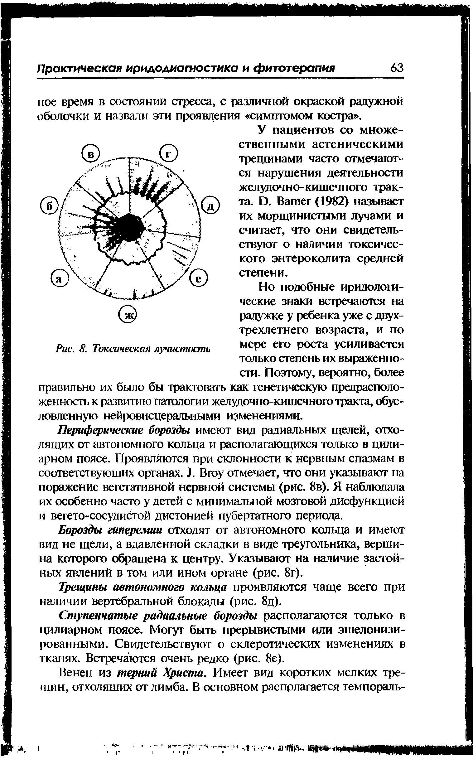 Рис. 8. Токсическая лучистость мере его роста усиливается только степень их выраженности. Поэтому, вероятно, более правильно их было бы трактовать как генетическую предрасположенность к развитию патологии желудочно-кишечного тракта, обус...