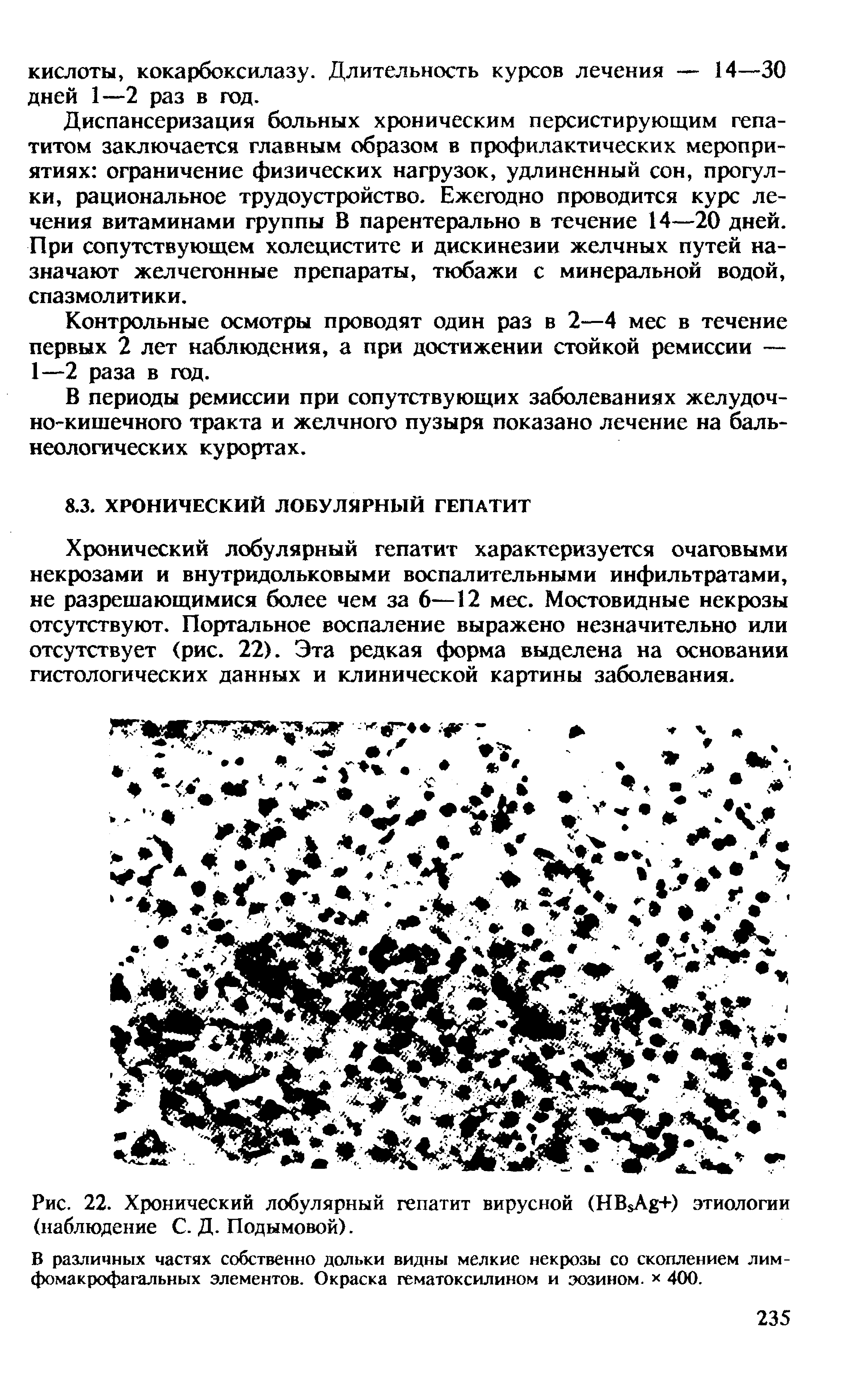 Рис. 22. Хронический лобулярный гепатит вирусной (HB A +) этиологии (наблюдение С. Д. Подымовой).