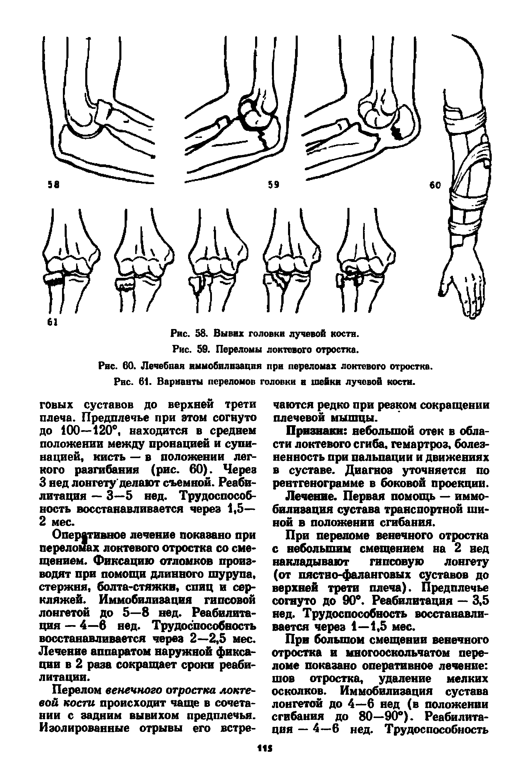 Закрытый перелом лучевой кости карта вызова