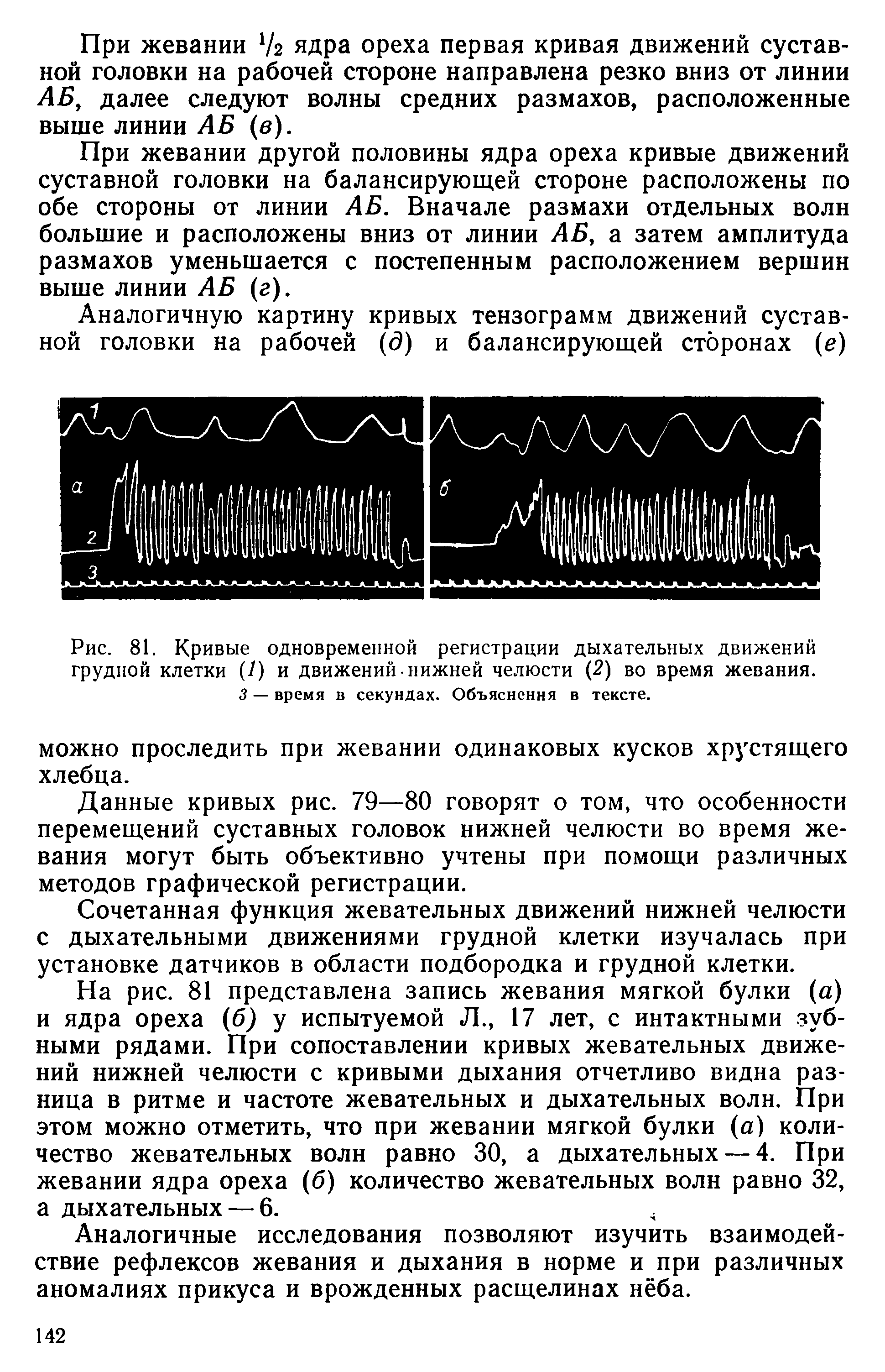 Рис. 81. Кривые одновременной регистрации дыхательных движений грудной клетки (/) и движений нижней челюсти (2) во время жевания.