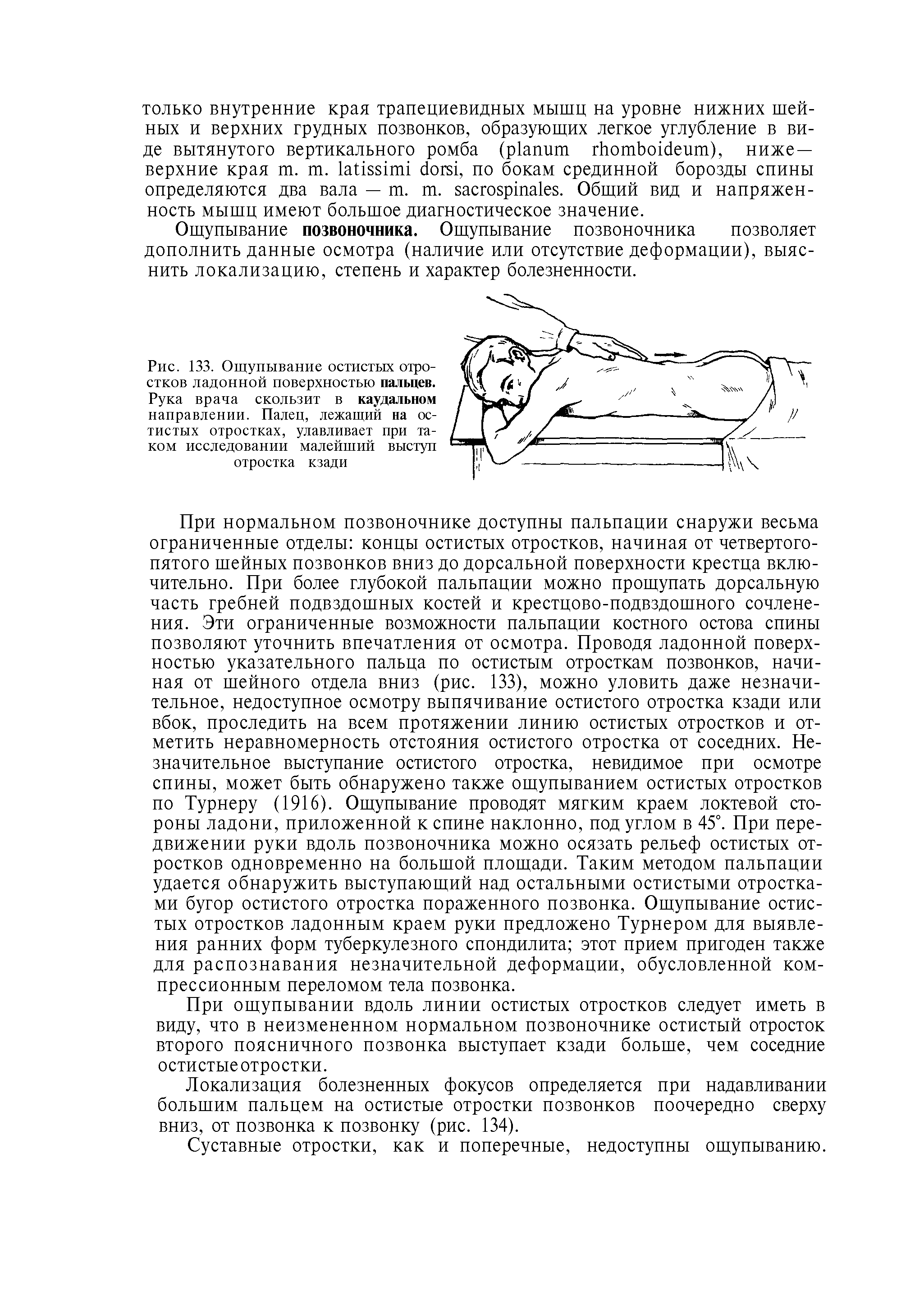 Рис. 133. Ощупывание остистых отростков ладонной поверхностью пальцев. Рука врача скользит в каудальном направлении. Палец, лежащий на остистых отростках, улавливает при таком исследовании малейший выступ отростка кзади...