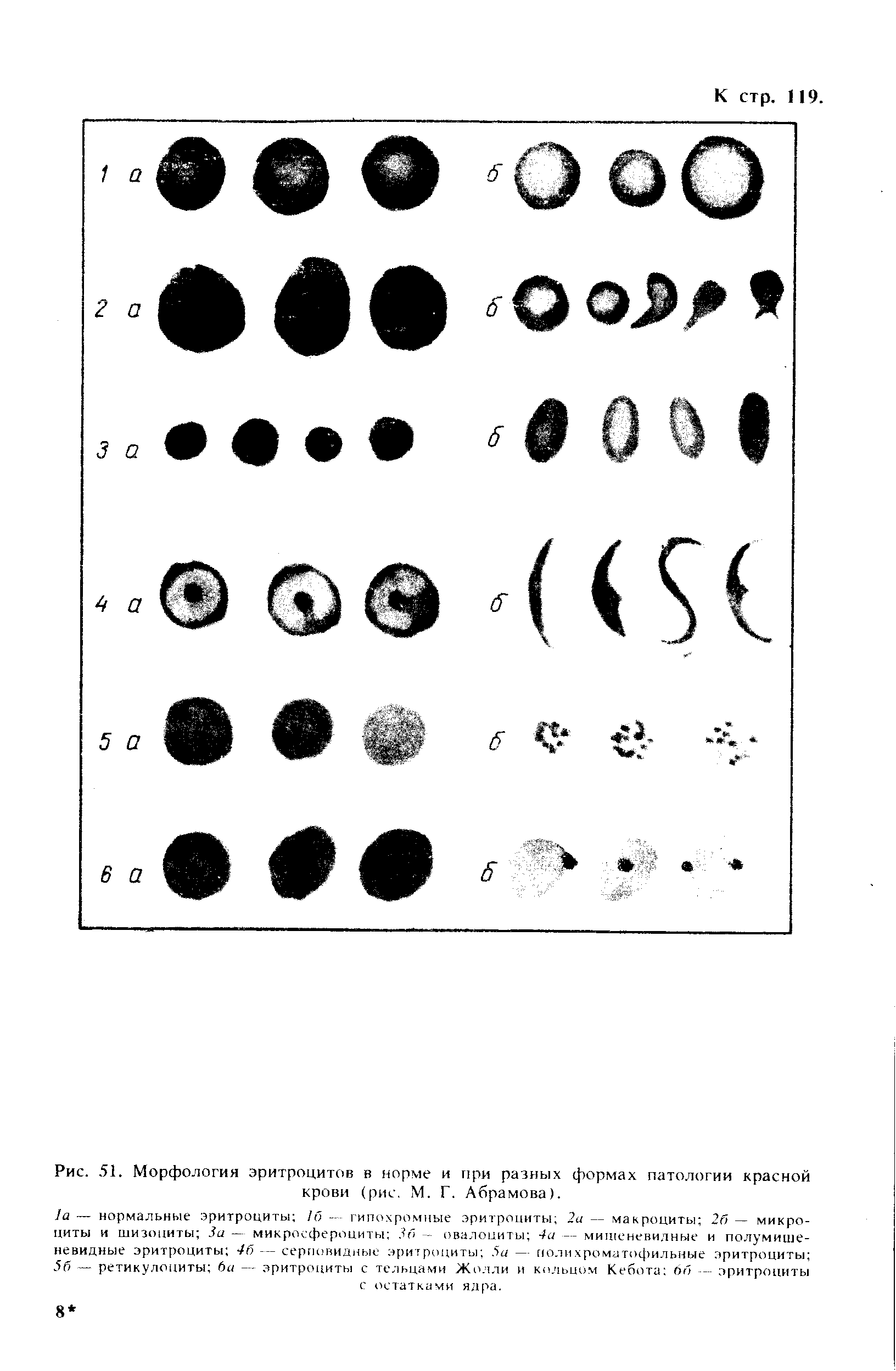 Рис. 51. Морфология эритроцитов в норме и при разных формах патологии красной крови (рис. М. Г. Абрамова).