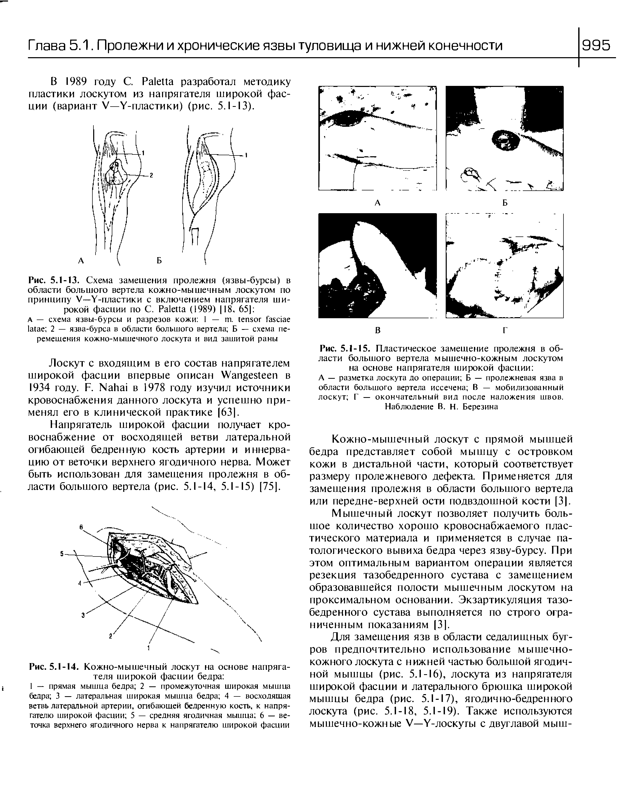 Рис. 5.1-13. Схема замещения пролежня (язвы-бурсы) в области большого вертела кожно-мышечным лоскутом по принципу V—Y-пластики с включением напрягателя широкой фасции по С. P (1989) 118, 65] ...