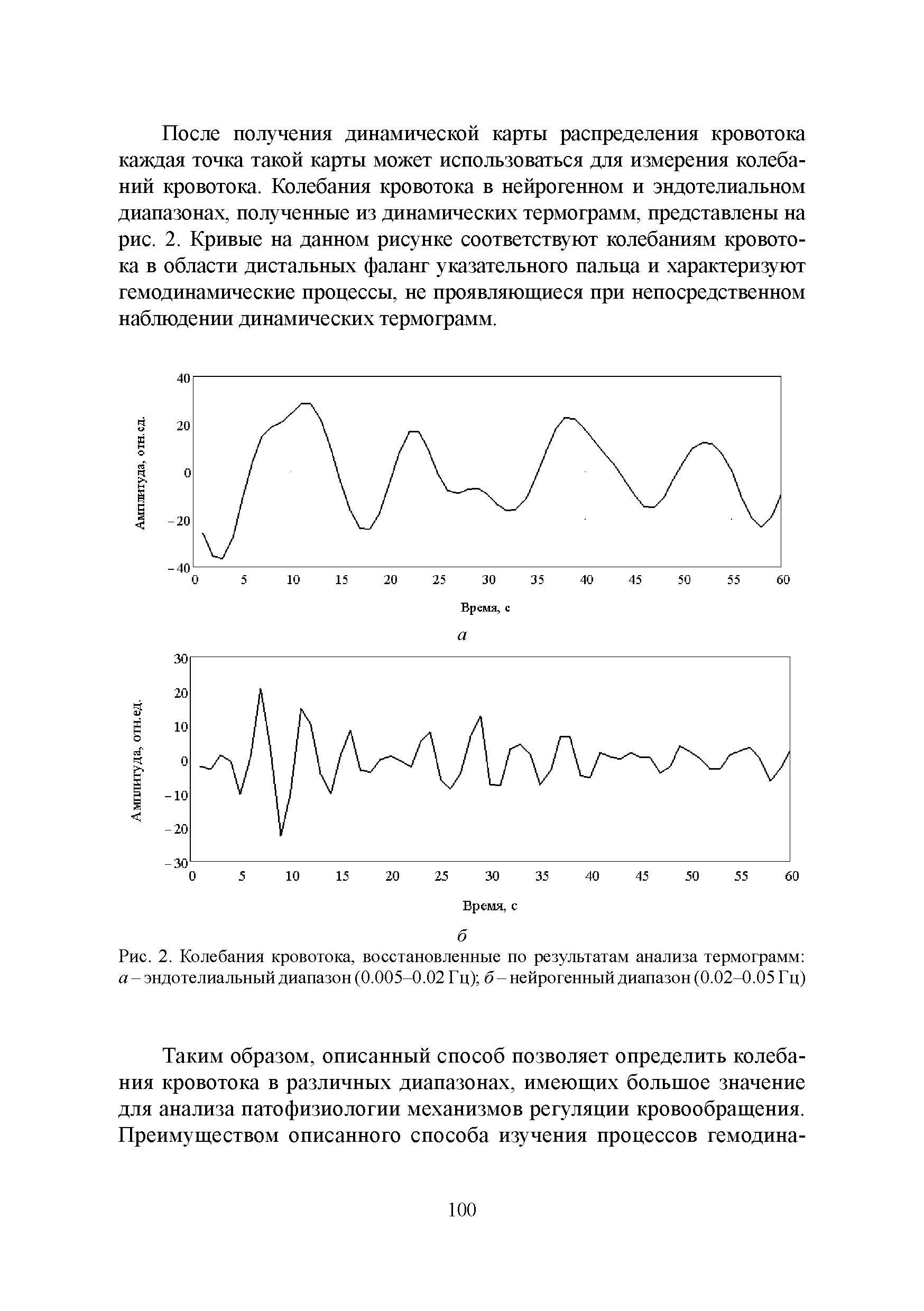 Рис. 2. Колебания кровотока, восстановленные по результатам анализа термограмм а - эндотелиальный диапазон (0.005-0.02 Гц) б- нейрогенный диапазон (0.02-0.05 Гц)...