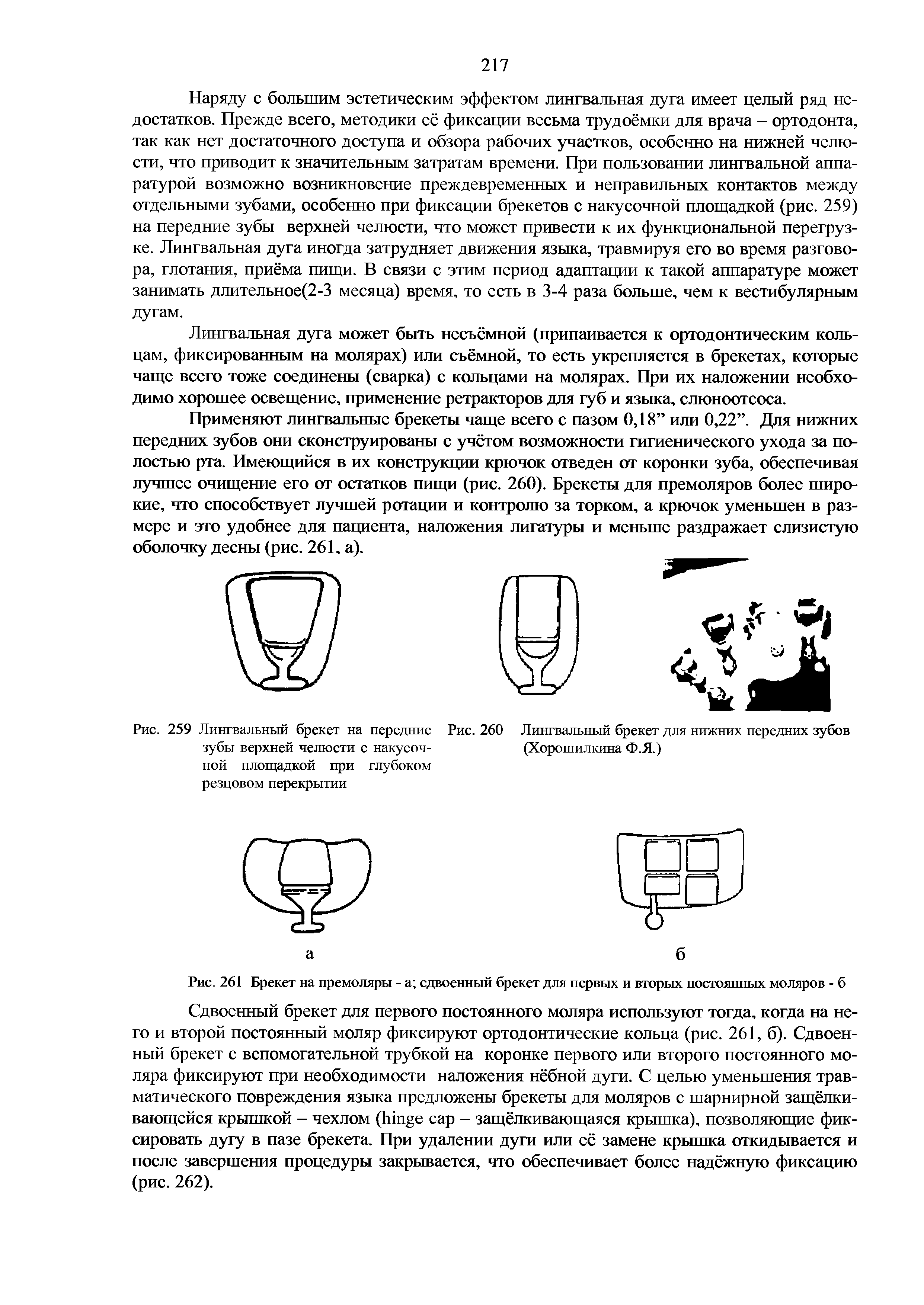 Рис. 259 Лингвальный брекет на передние Рис. 260 Лингвальный брекет для нижних передних зубов зубы верхней челюсти с накусоч- (Хорошилкина Ф.Я.)...
