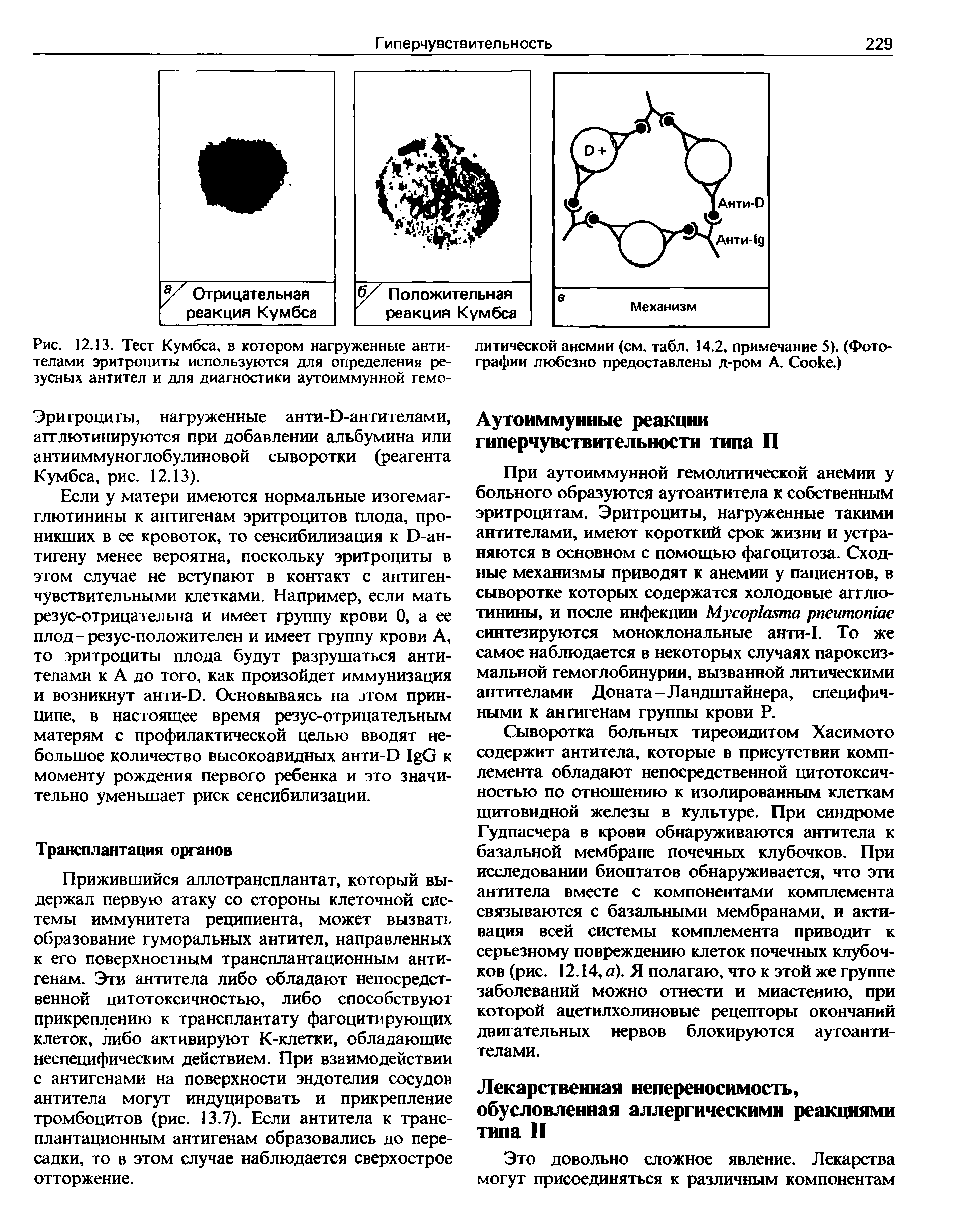 Рис. 12.13. Тест Кумбса, в котором нагруженные антителами эритроциты используются для определения резусных антител и для диагностики аутоиммунной гемо-...
