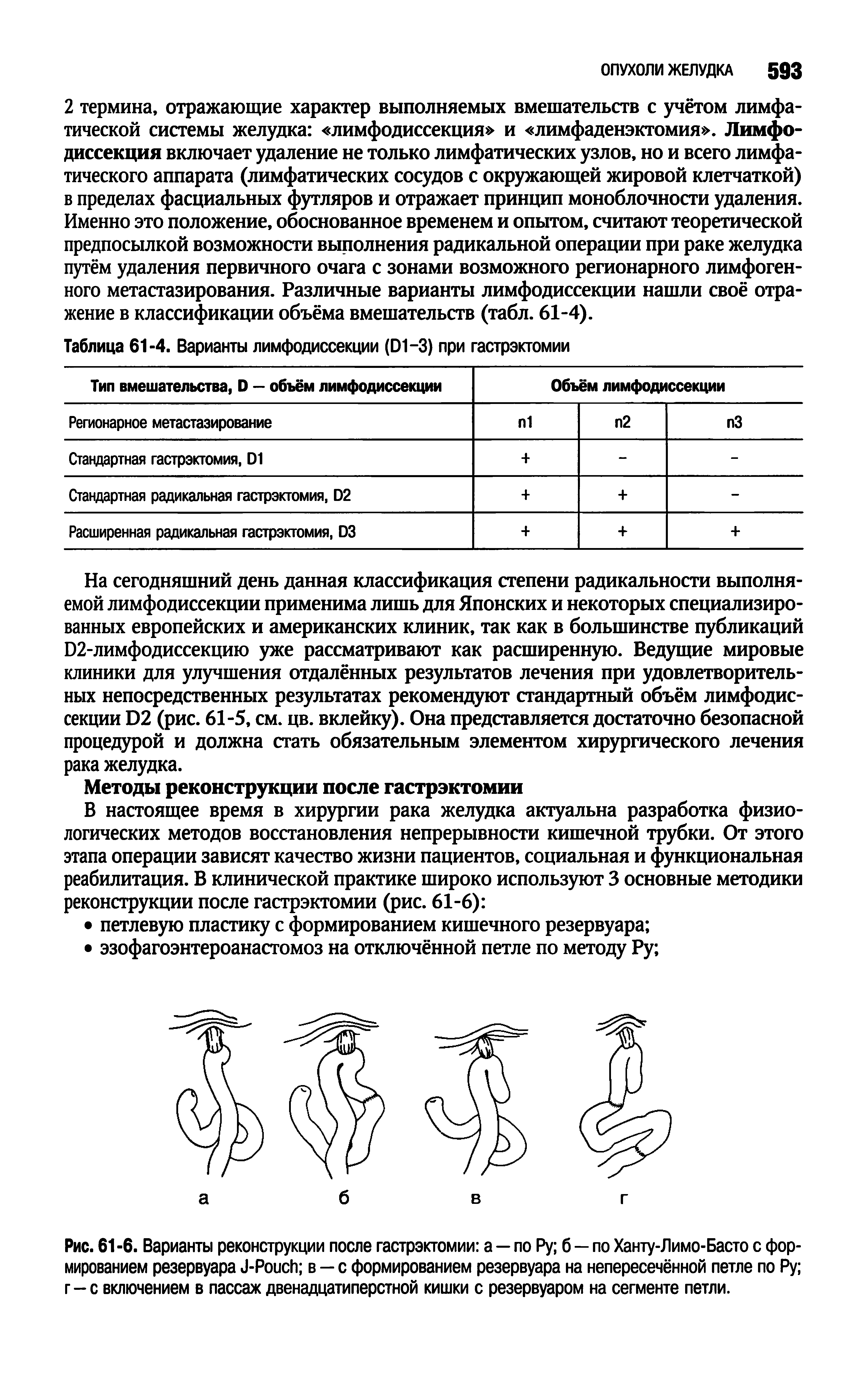 Рис. 61-6. Варианты реконструкции после гастрэктомии а — по Ру б — по Ханту-Лимо-Басто с формированием резервуара J-P в — с формированием резервуара на непересечённой петле по Ру г-с включением в пассаж двенадцатиперстной кишки с резервуаром на сегменте петли.