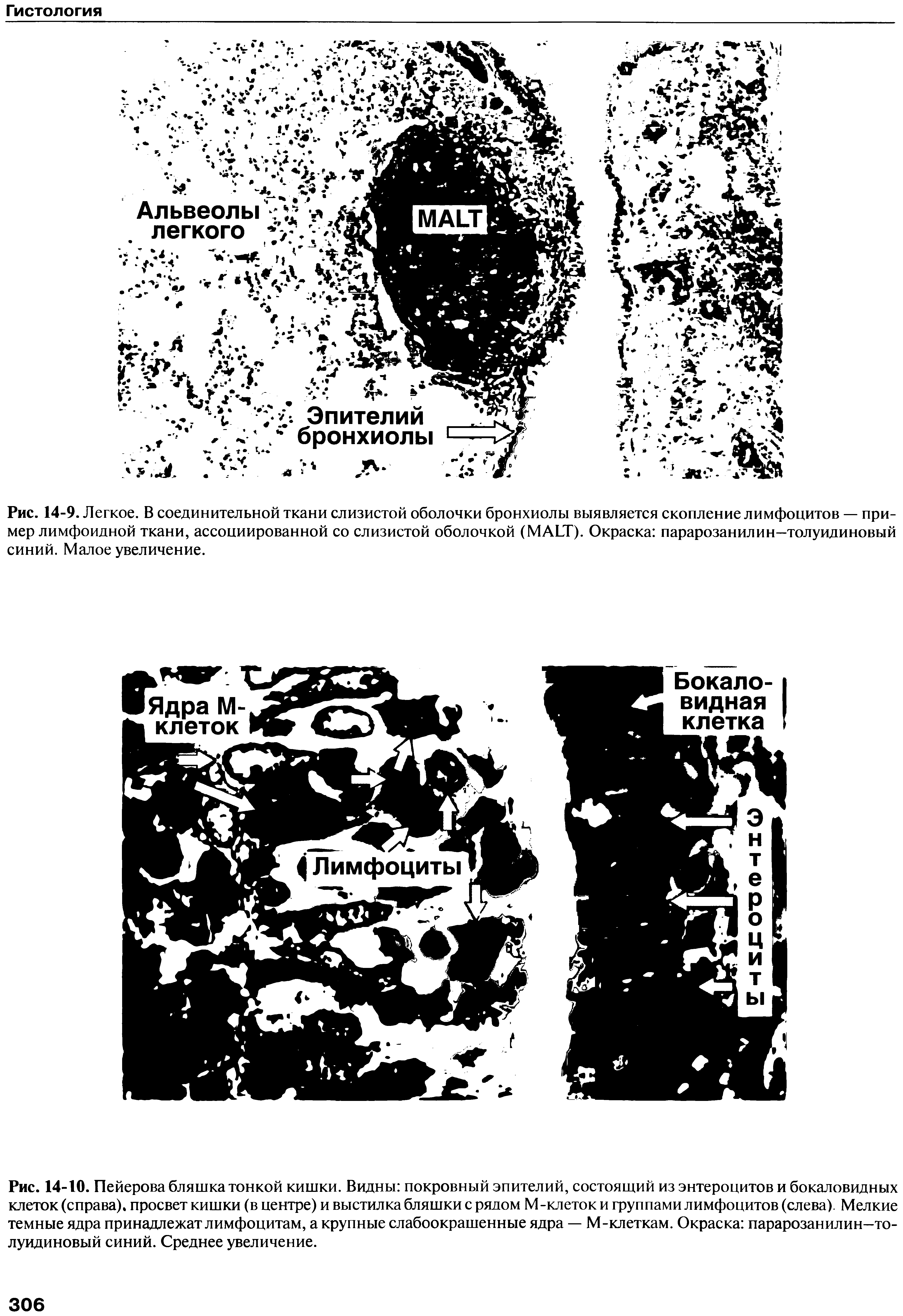 Рис. 14-9. Легкое. В соединительной ткани слизистой оболочки бронхиолы выявляется скопление лимфоцитов — пример лимфоидной ткани, ассоциированной со слизистой оболочкой (MALT). Окраска парарозанилин—толуидиновый синий. Малое увеличение.
