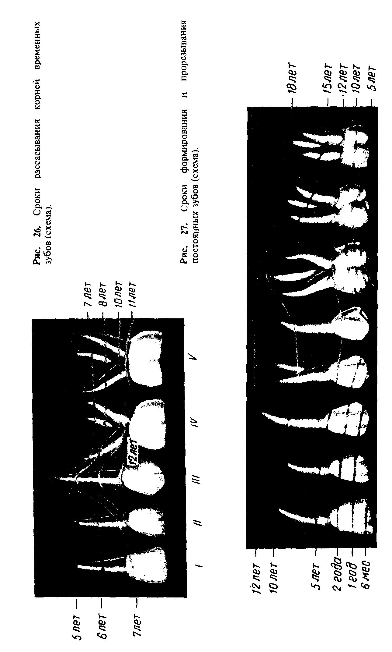 Рис. 27. Сроки формирования и прорезывания постоянных зубов (схема).