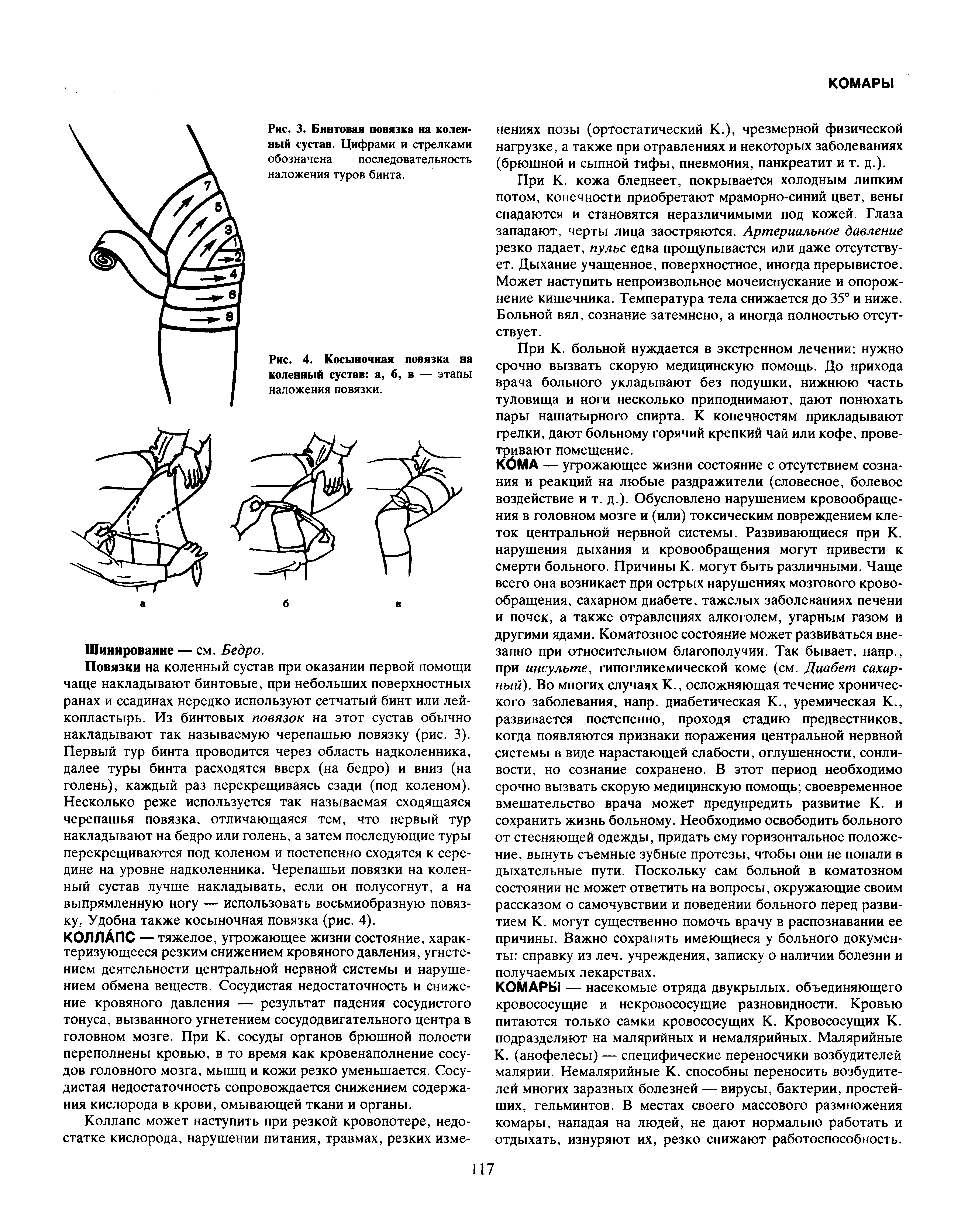 Рис. 4. Косыночная повязка на коленный сустав, а, б, в — этапы наложения повязки.