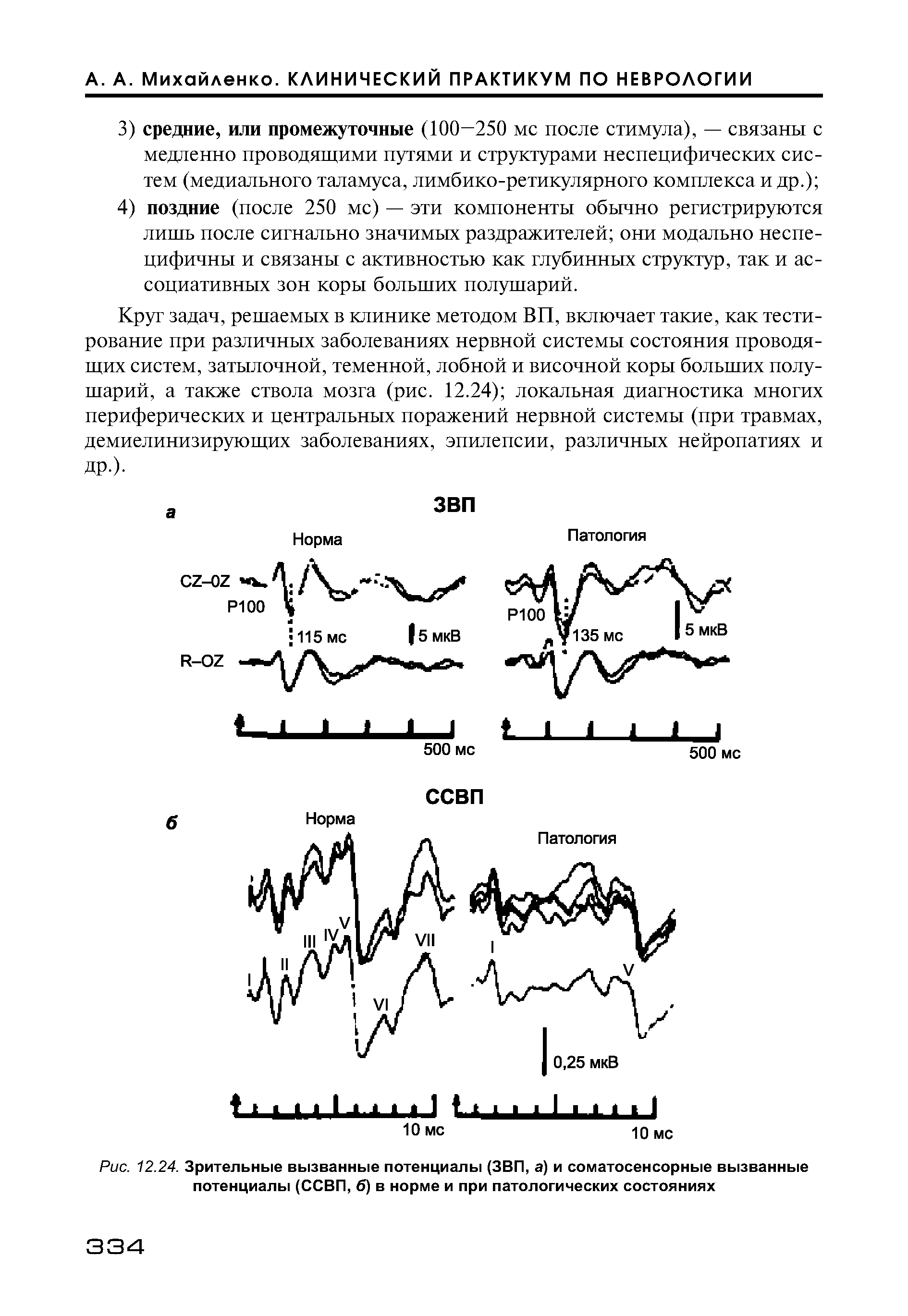 Рис. 12.24. Зрительные вызванные потенциалы (ЗВП, а) и соматосенсорные вызванные потенциалы (ССВП, б) в норме и при патологических состояниях...