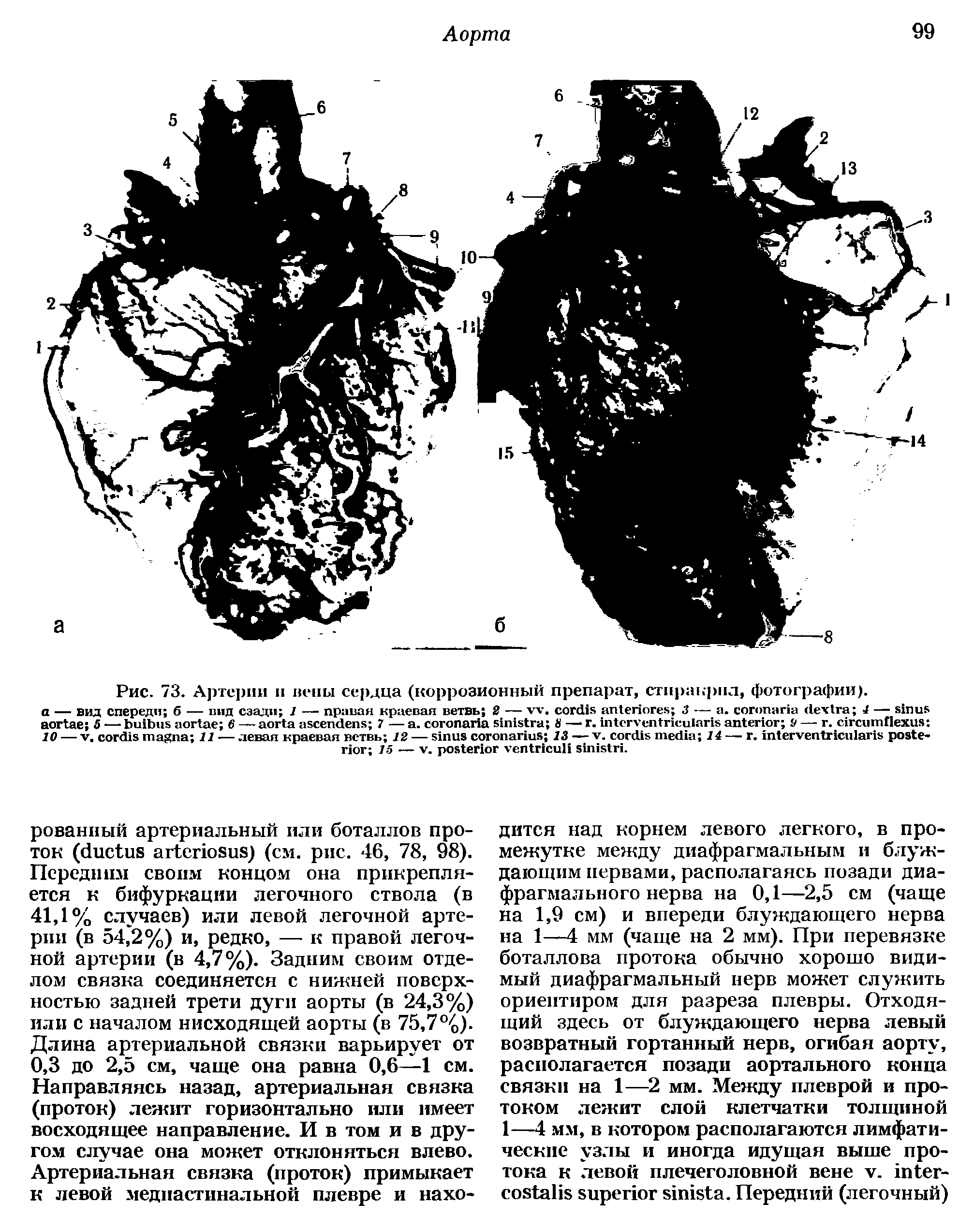 Рис. 73. Артерии и вены сердца (коррозионный препарат, стпракрпл, фотографии).