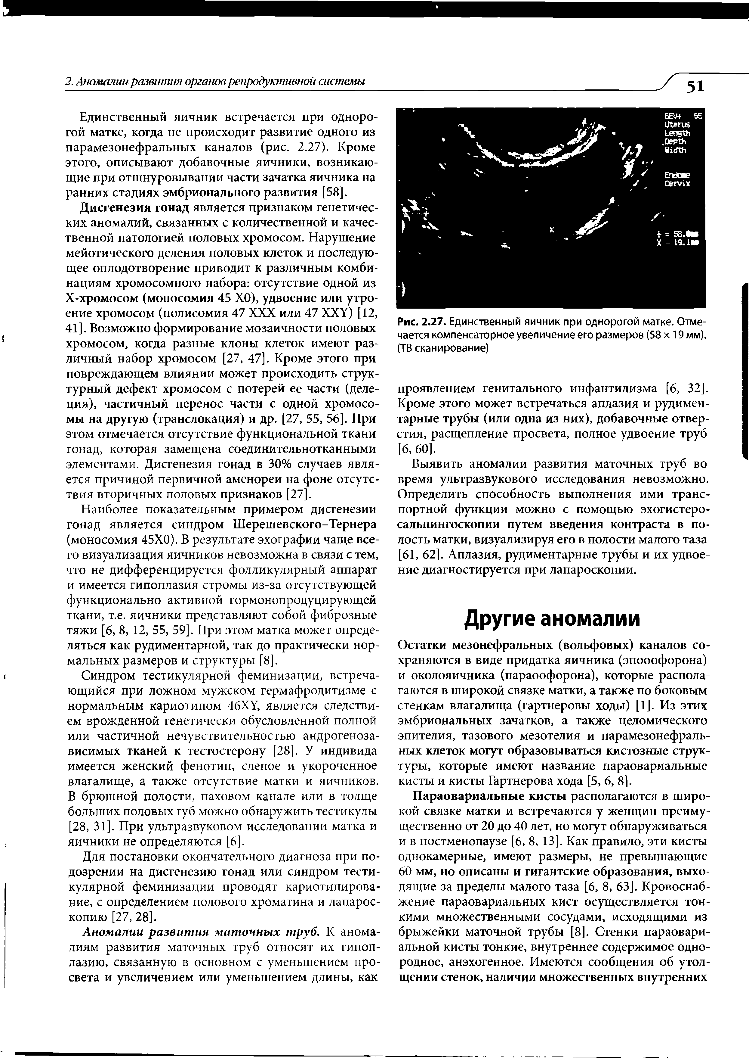 Рис. 2.27. Единственный яичник при однорогой матке. Отмечается компенсаторное увеличение его размеров (58 х 19 мм). (ТВ сканирование)...