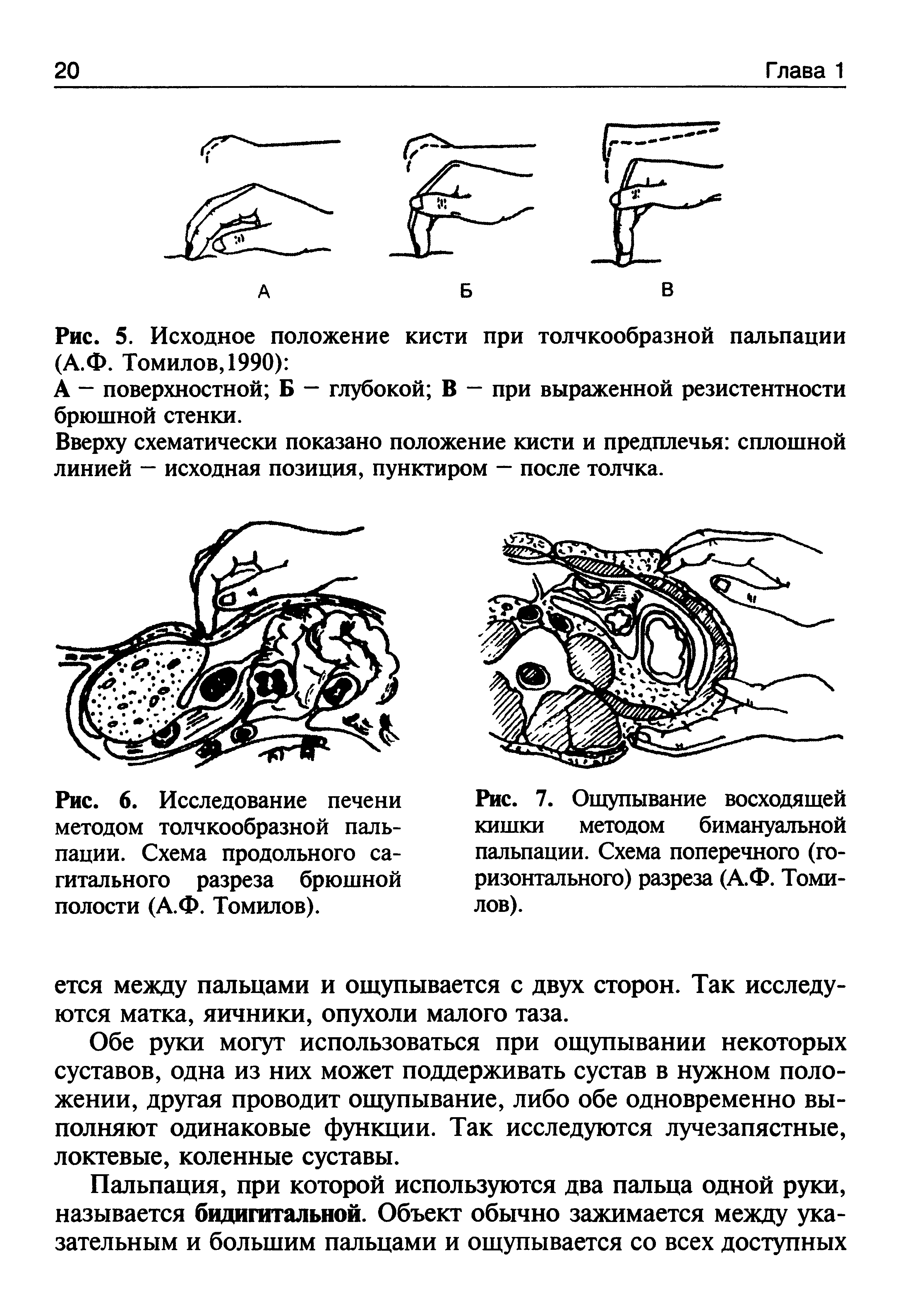 Рис. 7. Ощупывание восходящей кишки методом бимануальной пальпации. Схема поперечного (горизонтального) разреза (А.Ф. Томилов).