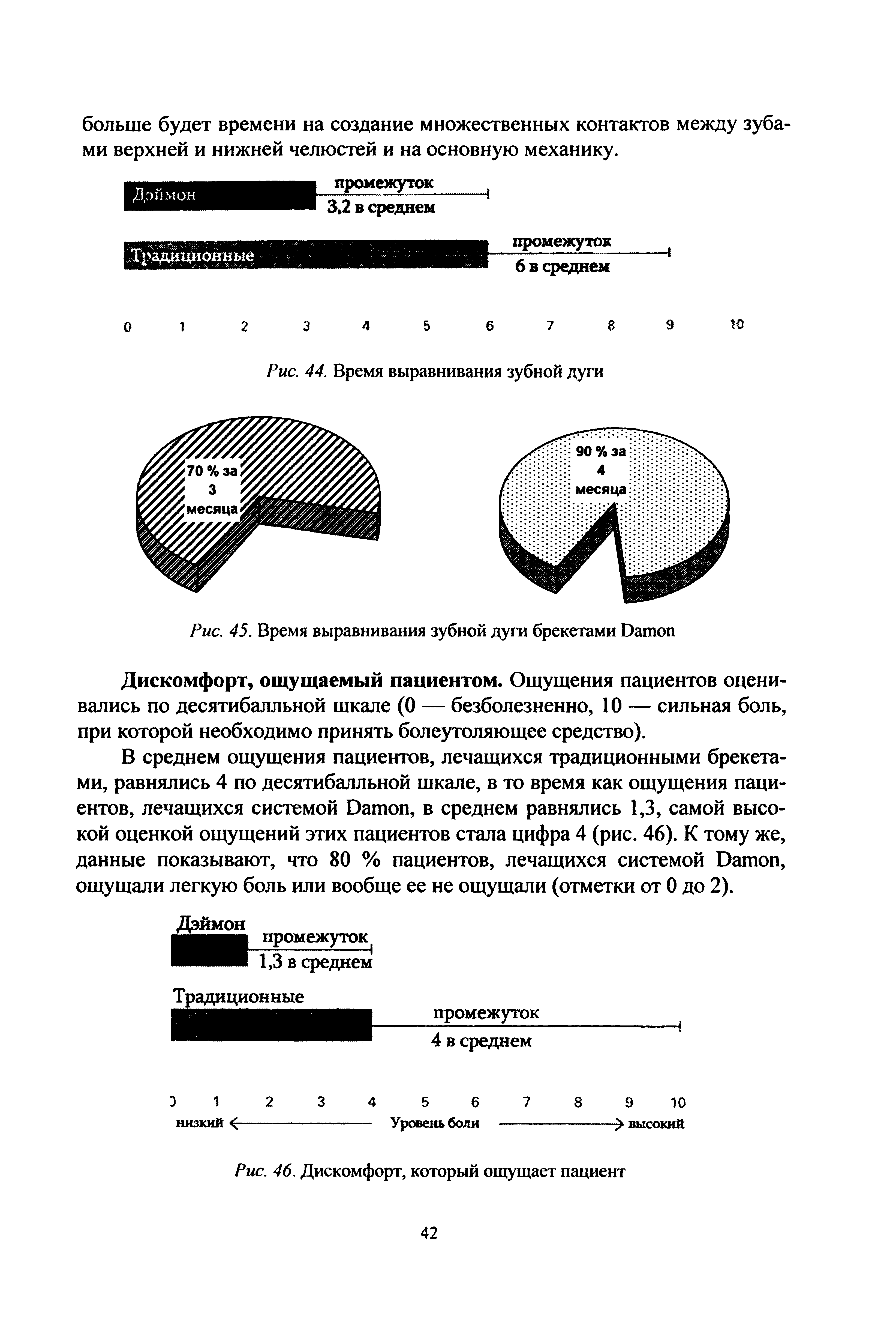 Рис. 45. Время выравнивания зубной дуги брекетами D ...