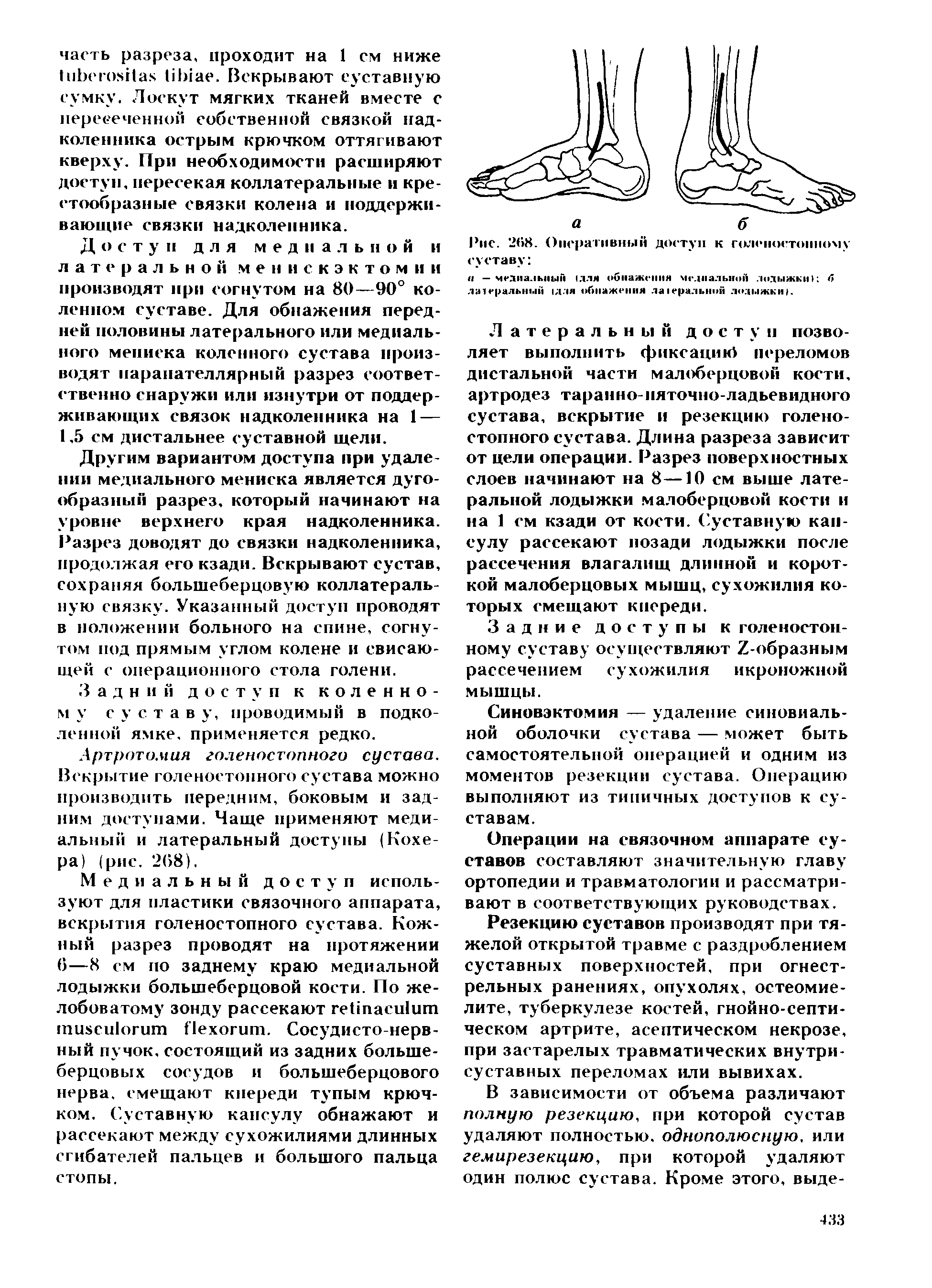 Рис. 268. Оперативный доступ к голеностопному суставу <1 — медиальный (для обнажения медиальной лодыжки) б латеральный (для обнажения ла1еральнон лодыжки).