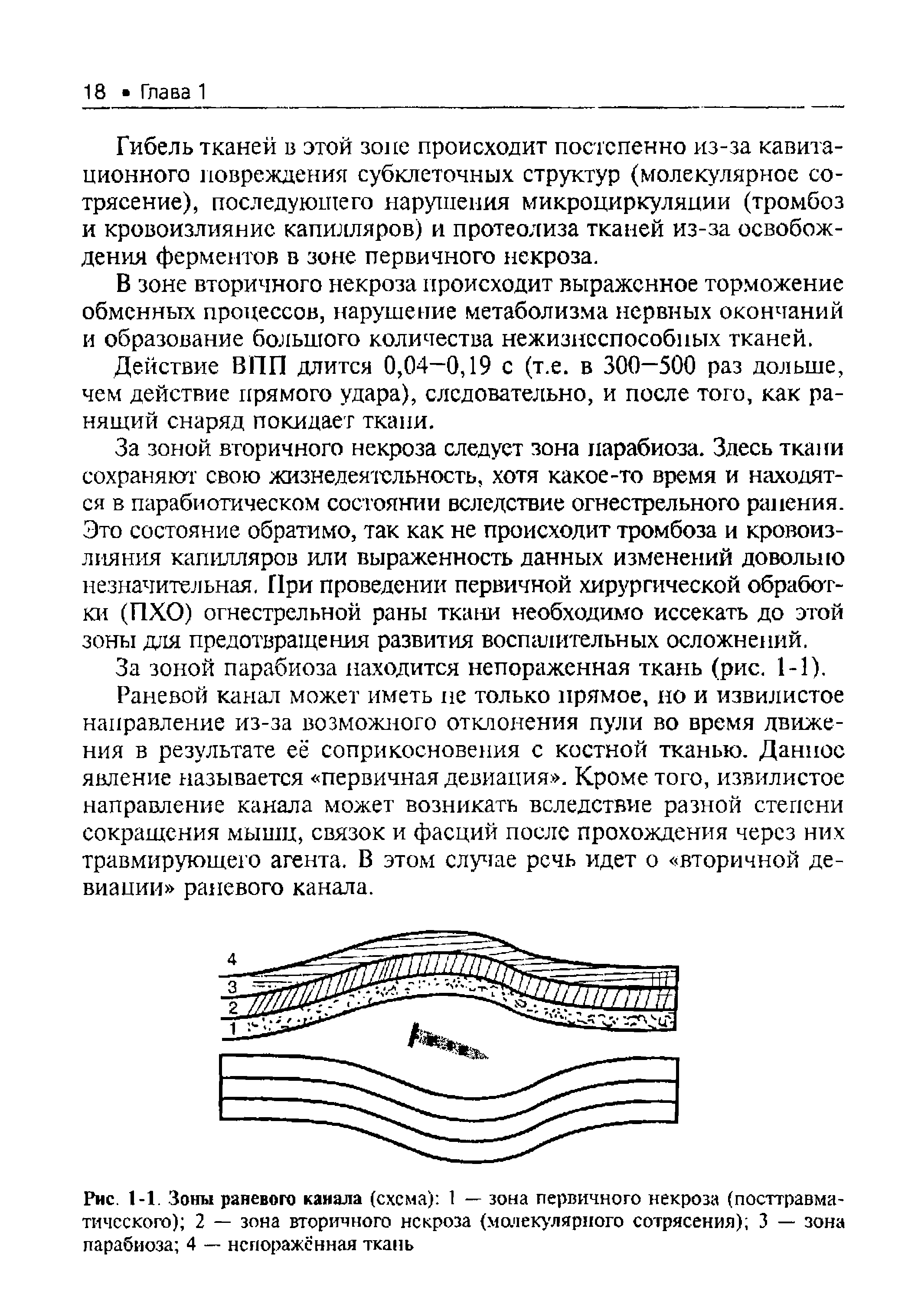 Рис. 1-1. Зоны раневого канала (схема) 1 — зона первичного некроза (посттравматического) 2 — зона вторичного некроза (молекулярного сотрясения) 3 — зона парабиоза 4 — непораженная ткань...