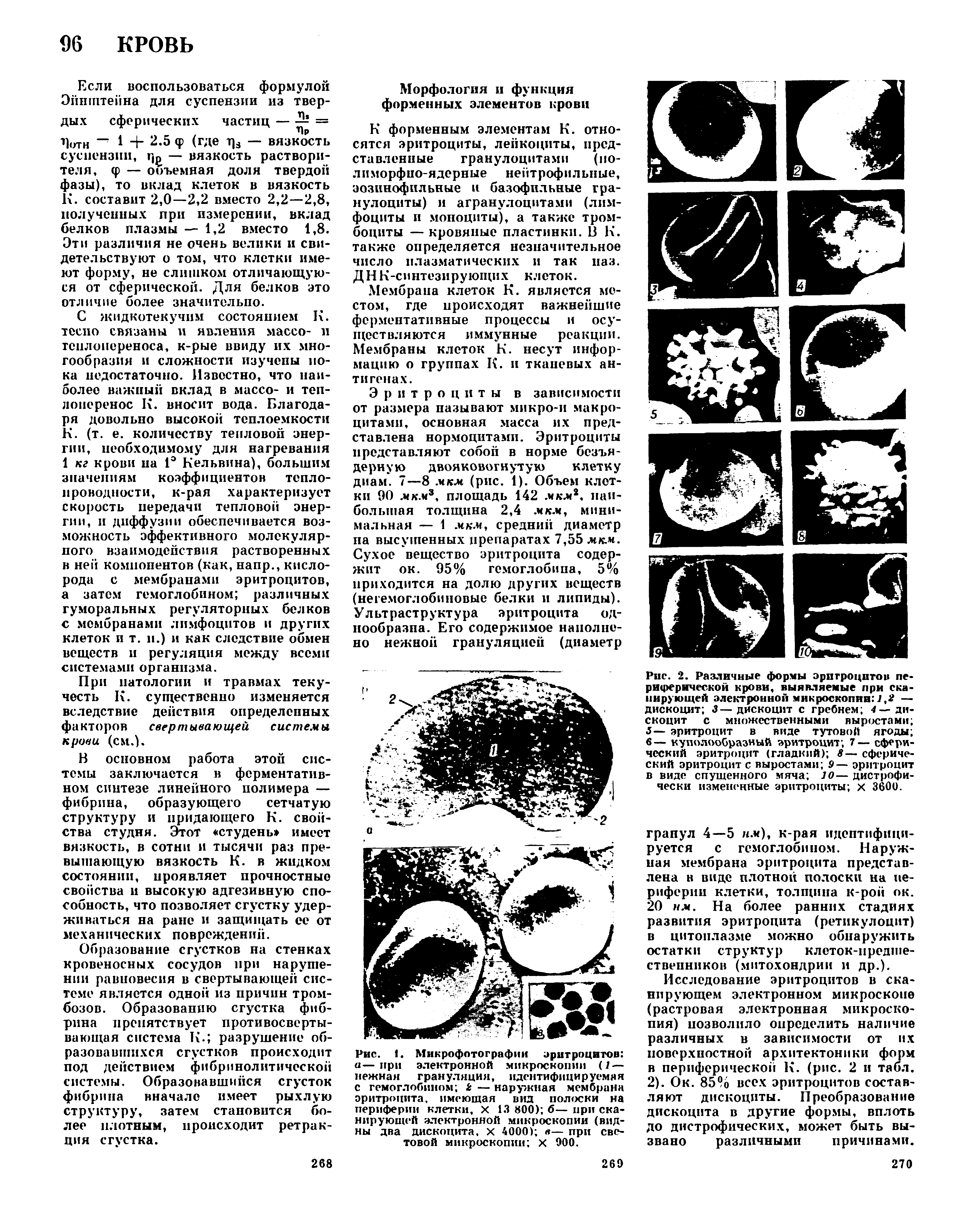 Рис. 1. Микрофотографии эритроцитов а—при электронной микроскопии (/ — нежная грануляция, идентифицируемая с гемоглобином 2 — наружная мембрана эритроцита, имеющая вид полоски на периферии клетки, х 13 800) б— при сканирующей электронной микроскопии (видны два дискоцита, X 4000) л— при световой микроскопии х 900.