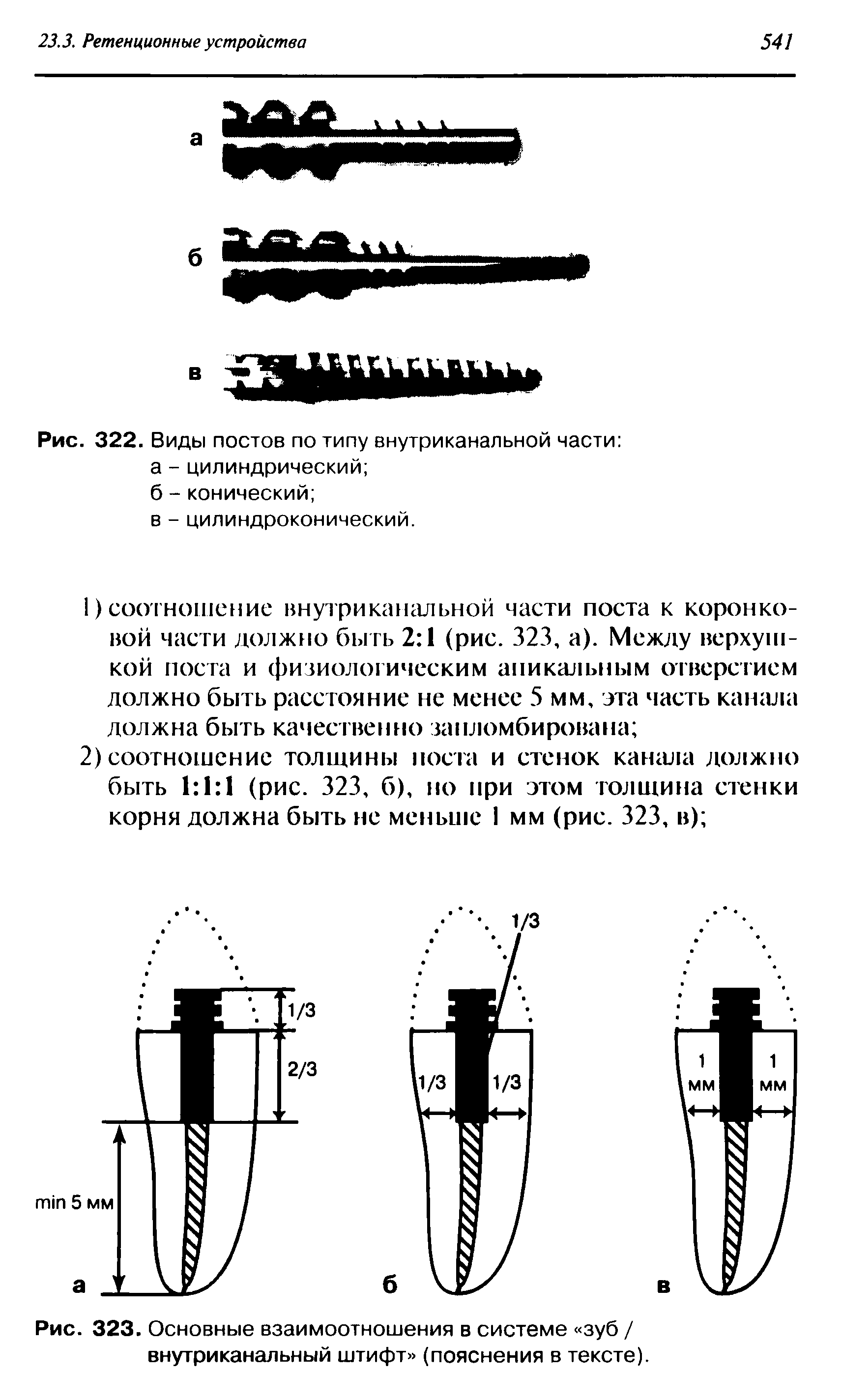 Рис. 323. Основные взаимоотношения в системе зуб / внутриканальный штифт (пояснения в тексте).