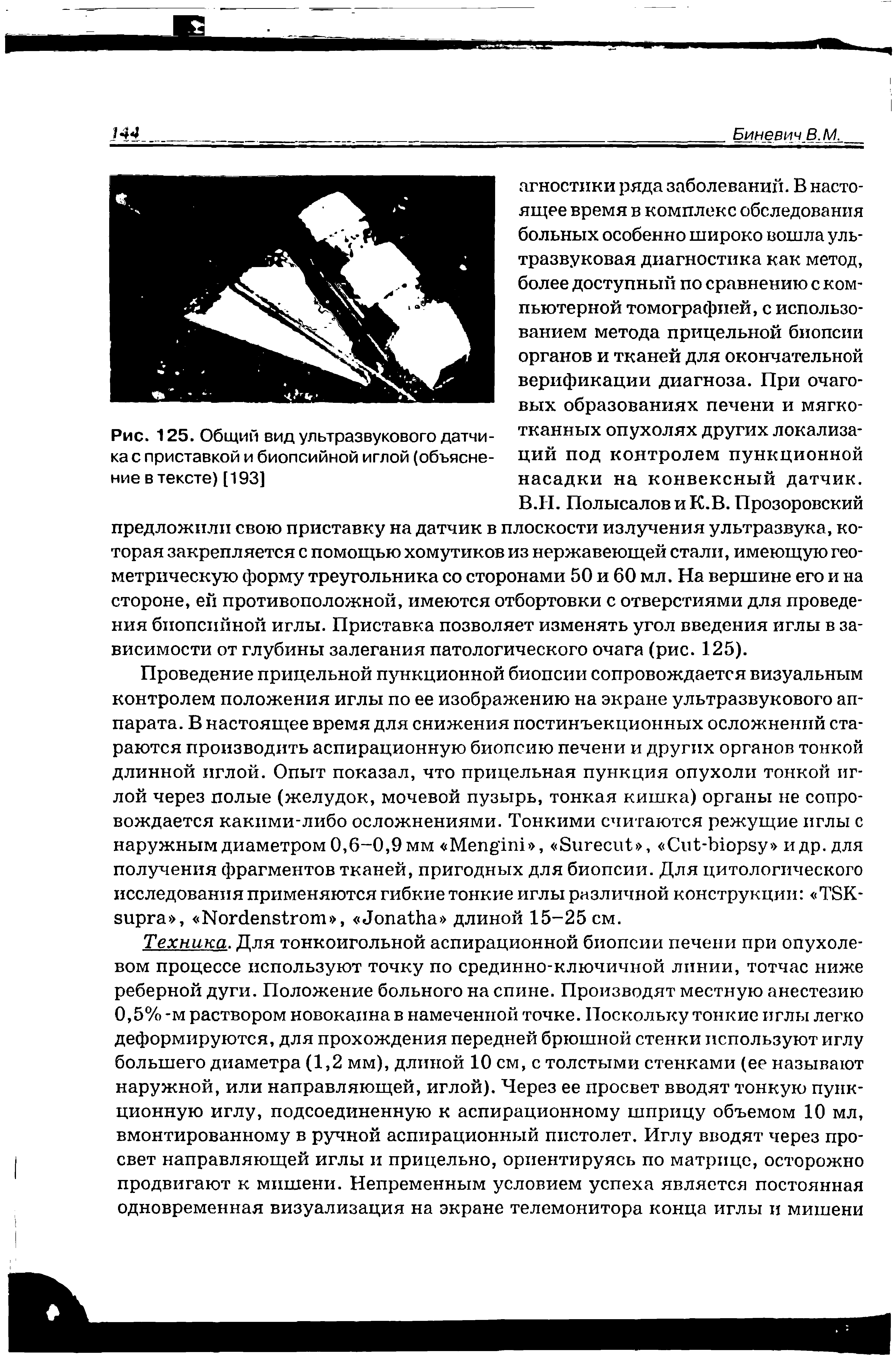 Рис. 125. Общий вид ультразвукового датчи- тканных опухолях других локализа-ка с приставкой и биопсийной иглой (объясне- ций под контролем пункционной ние в тексте) [193] насадки на конвексный датчик.