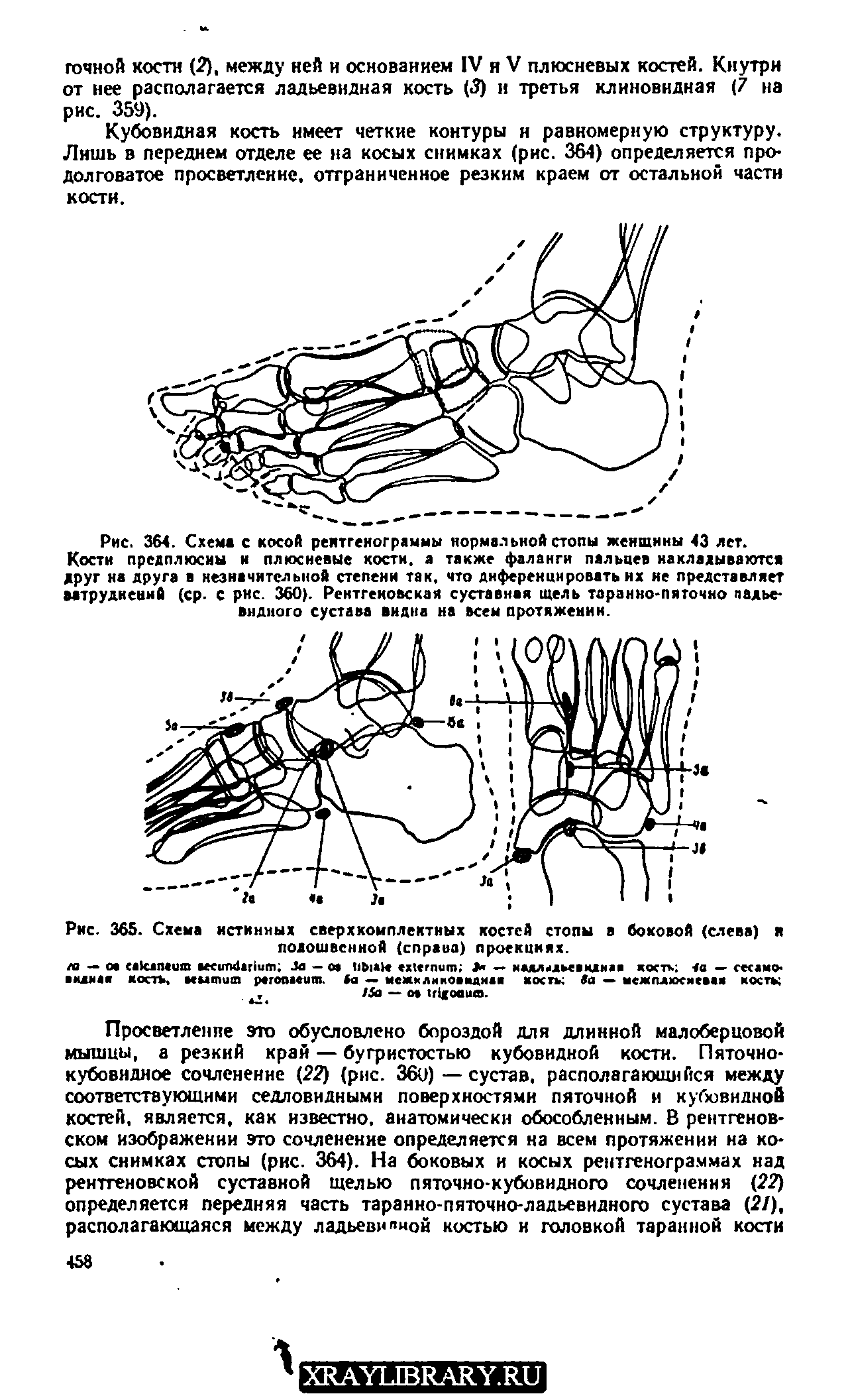 Рис. 365. Схема истинных сверхкомплектных костей стопы в боковой (слева) и подошвенной (справа) проекциях.