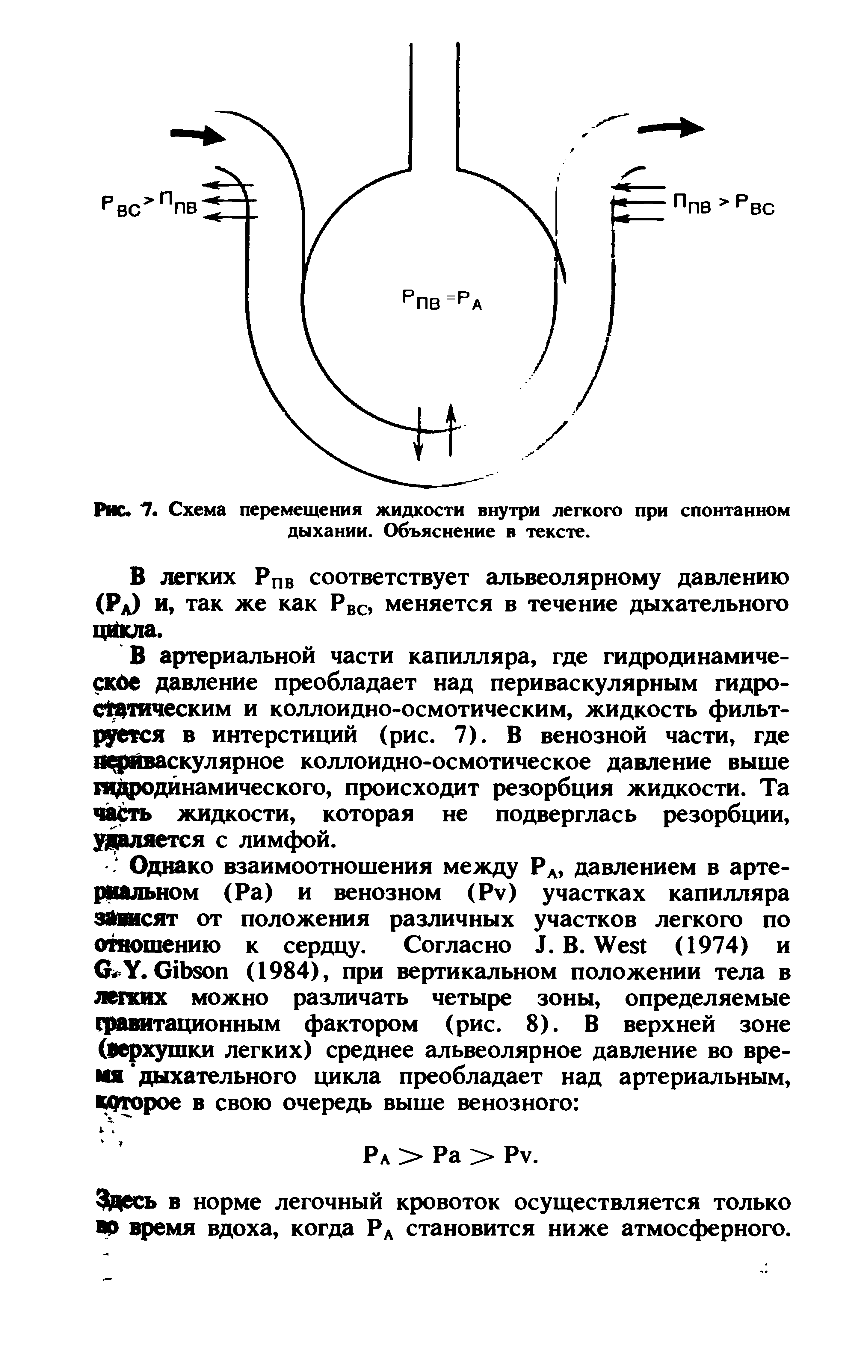 Рис. 7. Схема перемещения жидкости внутри легкого при спонтанном дыхании. Объяснение в тексте.