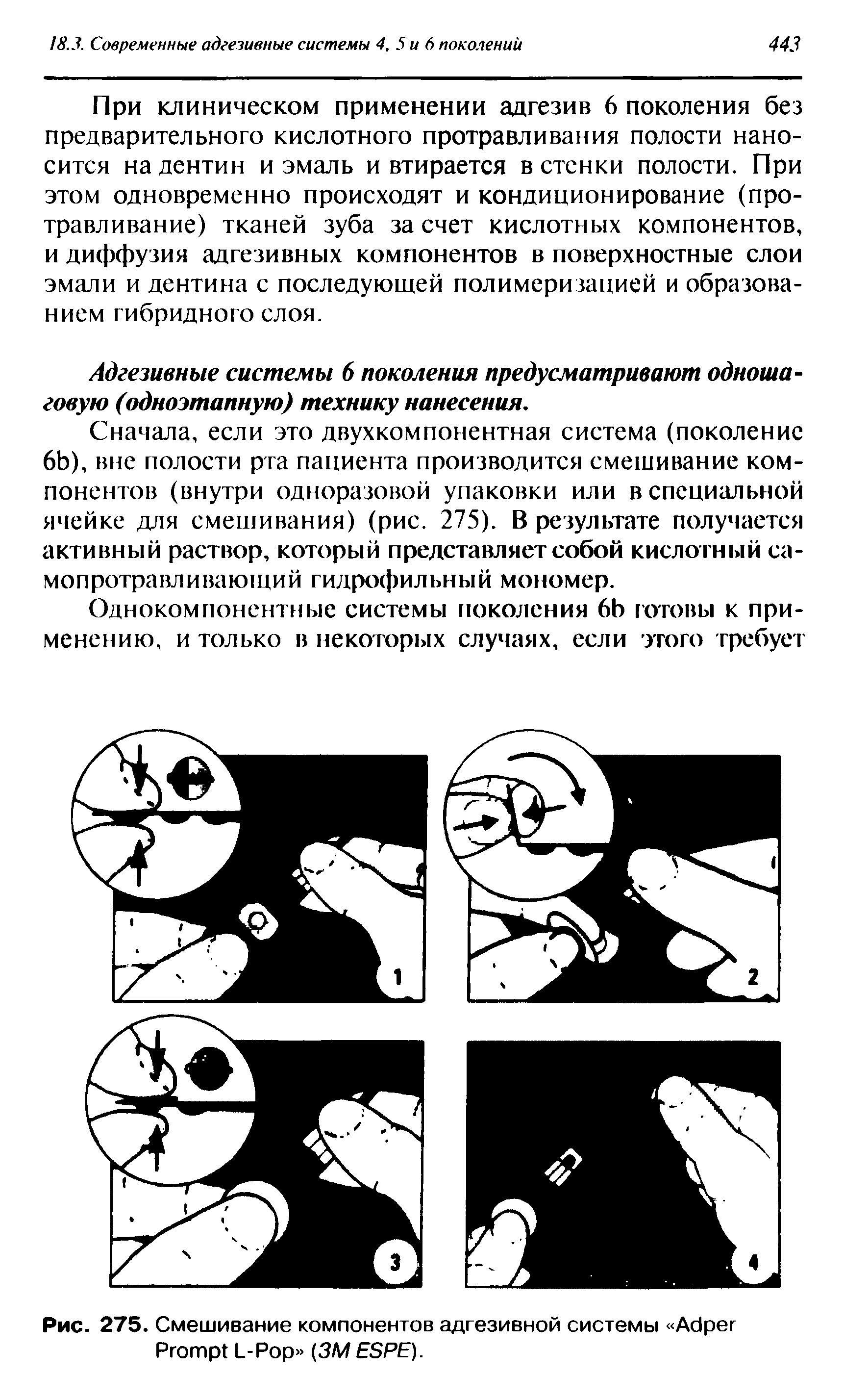 Рис. 275. Смешивание компонентов адгезивной системы A P L-P (3M ESPE).