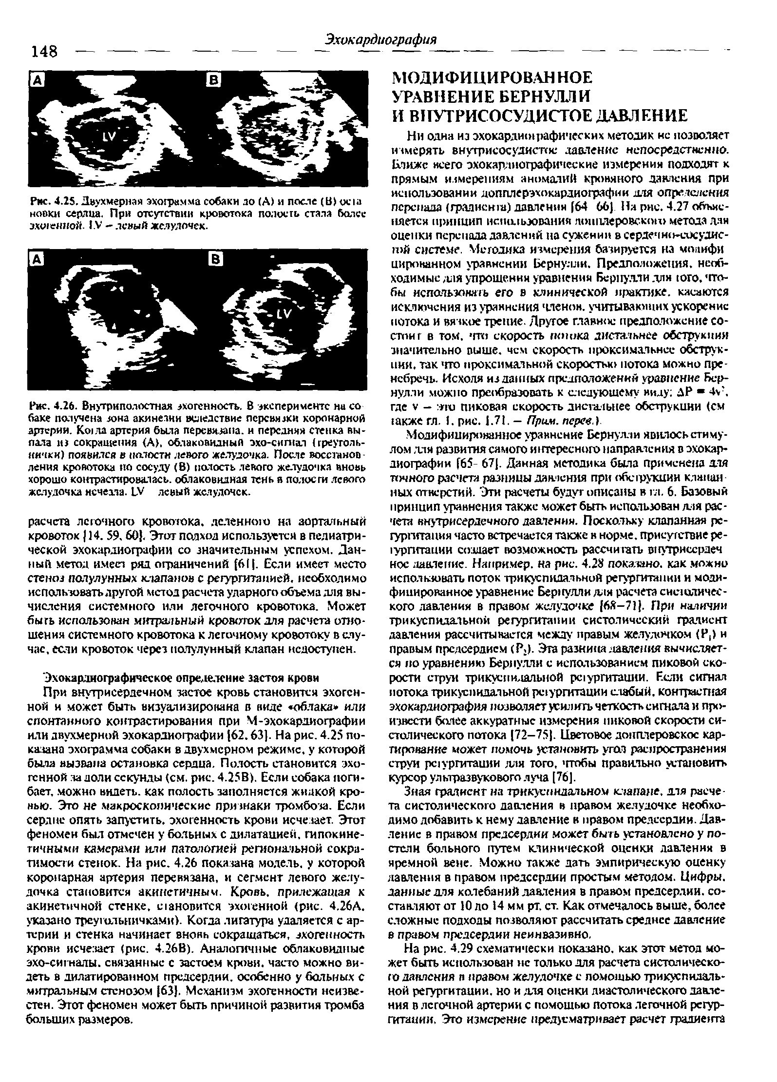 Рис. 4.25. Двухмерная эхограмма собаки ло (А) и после (И) истоки серлиа. При отсутствии кровотока полость стала более эхогенной. IV - левый желудочек.