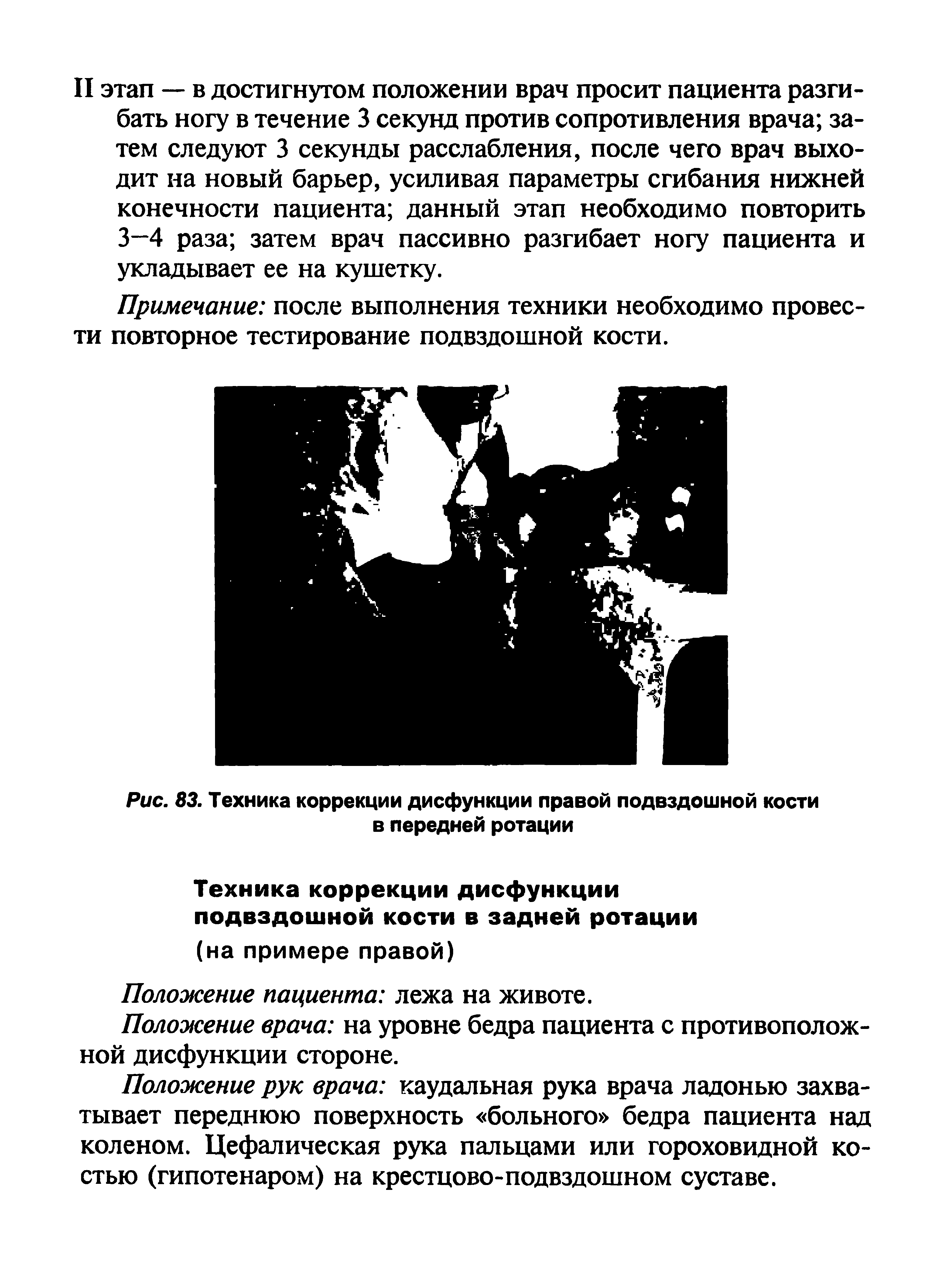 Рис. 83. Техника коррекции дисфункции правой подвздошной кости в передней ротации...