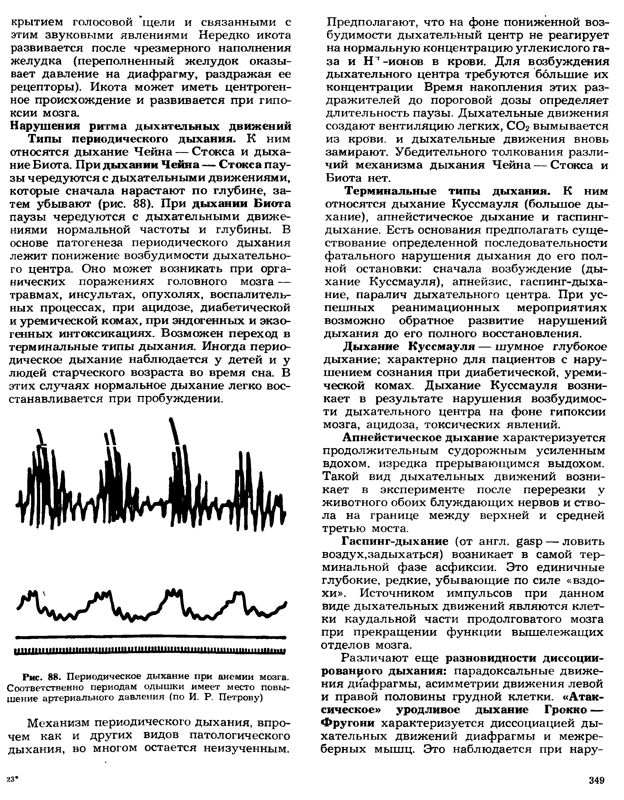 Рис. 88. Периодическое дыхание при анемии мозга. Соответственно периодам одышки имеет место повышение артериального давления (по И. Р. Петрову)...