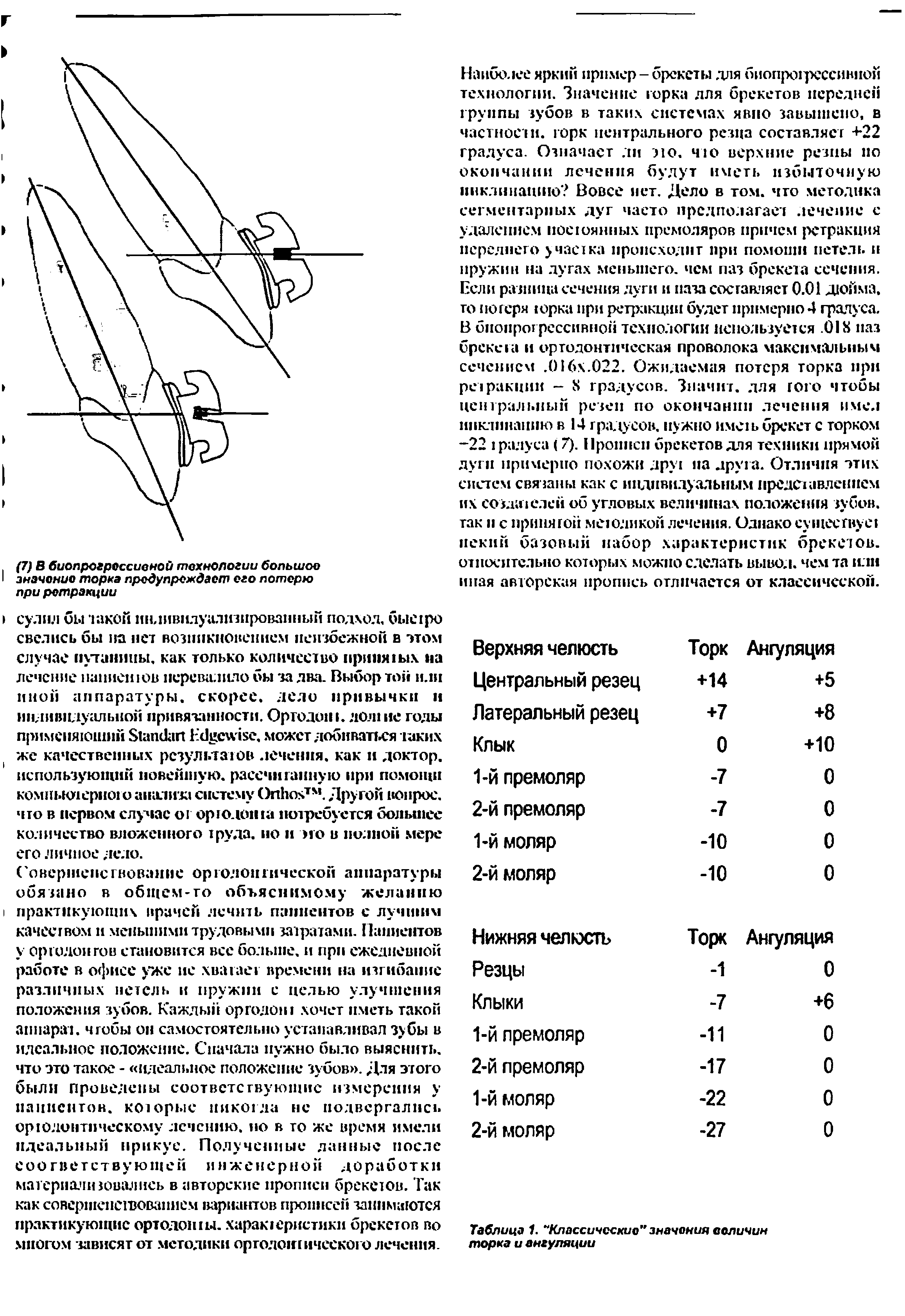 Таблица 1. Классические" значения величин торка и ангуляции...