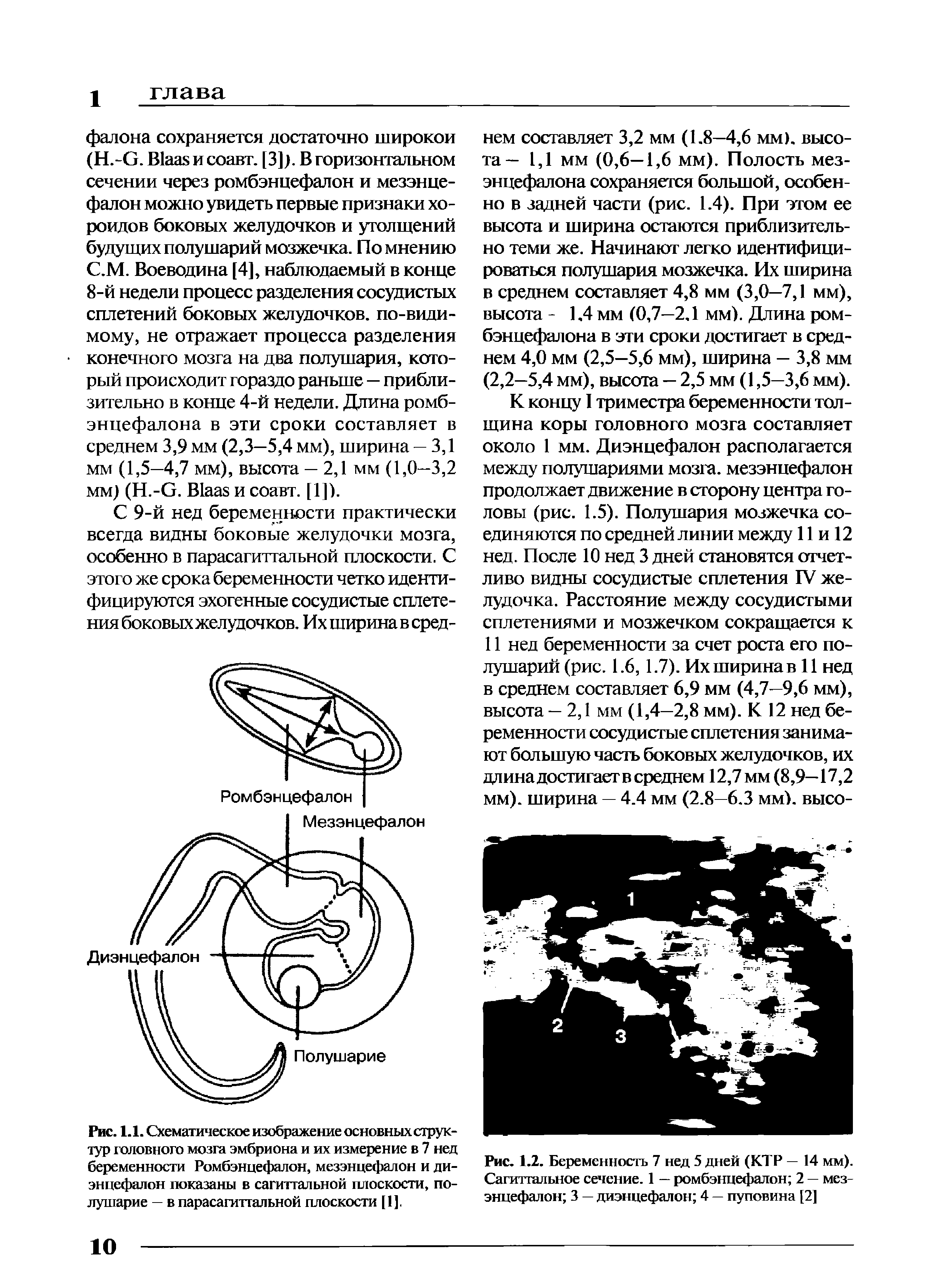 Рис. 1.1. Схематическое изображение основных структур головного мозга эмбриона и их измерение в 7 нед беременности Ромбэнцефалон, мезэнцефалон и диэнцефалон показаны в сагиттальной плоскости, полушарие — в парасагиттальной плоскости [1].