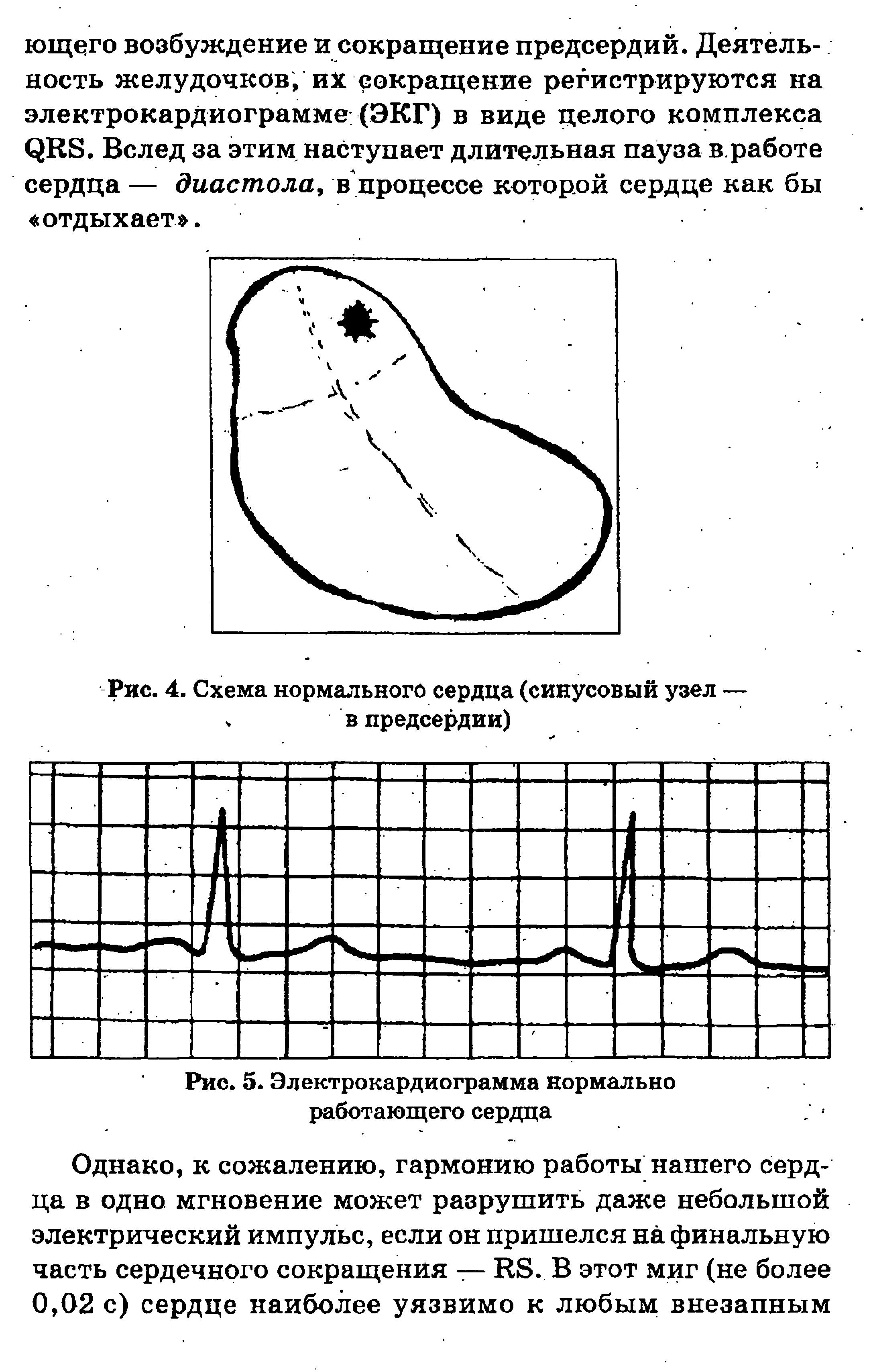 Рис. 4. Схема нормального сердца (синусовый узел — ч в предсердии)...