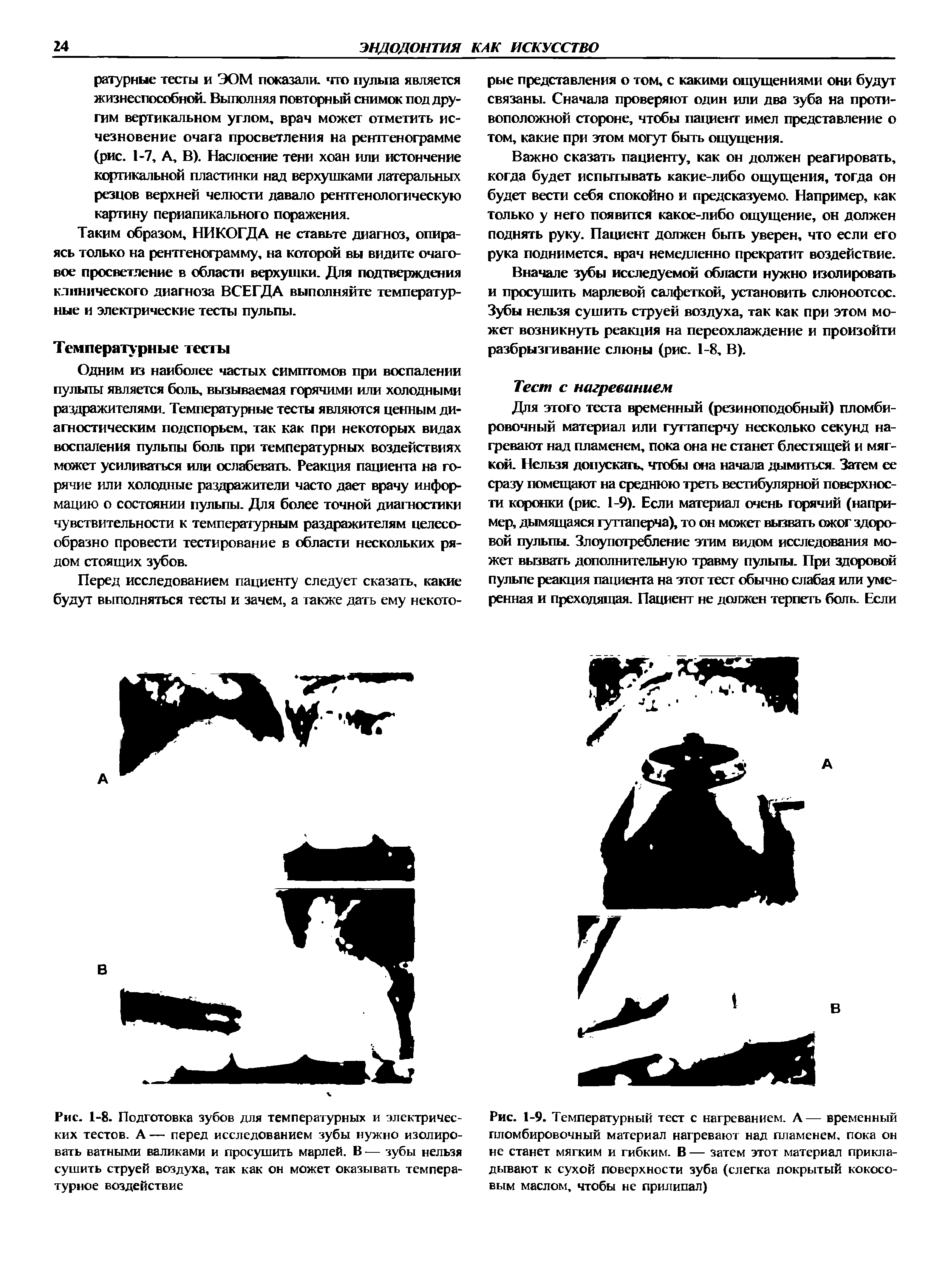 Рис. 1-8. Подготовка зубов для температурных и электрических тестов. А — перед исследованием зубы нужно изолировать ватными валиками и просушить марлей. В — зубы нельзя сушить струей воздуха, так как он может оказывать температурное воздействие...