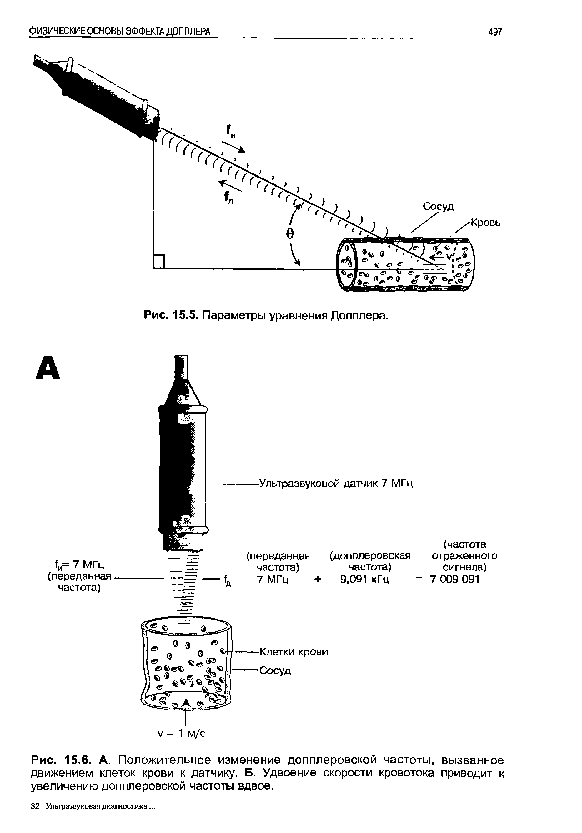 Рис. 15.6. А. Положительное изменение допплеровской частоты, вызванное движением клеток крови к датчику. Б. Удвоение скорости кровотока приводит к увеличению допплеровской частоты вдвое.